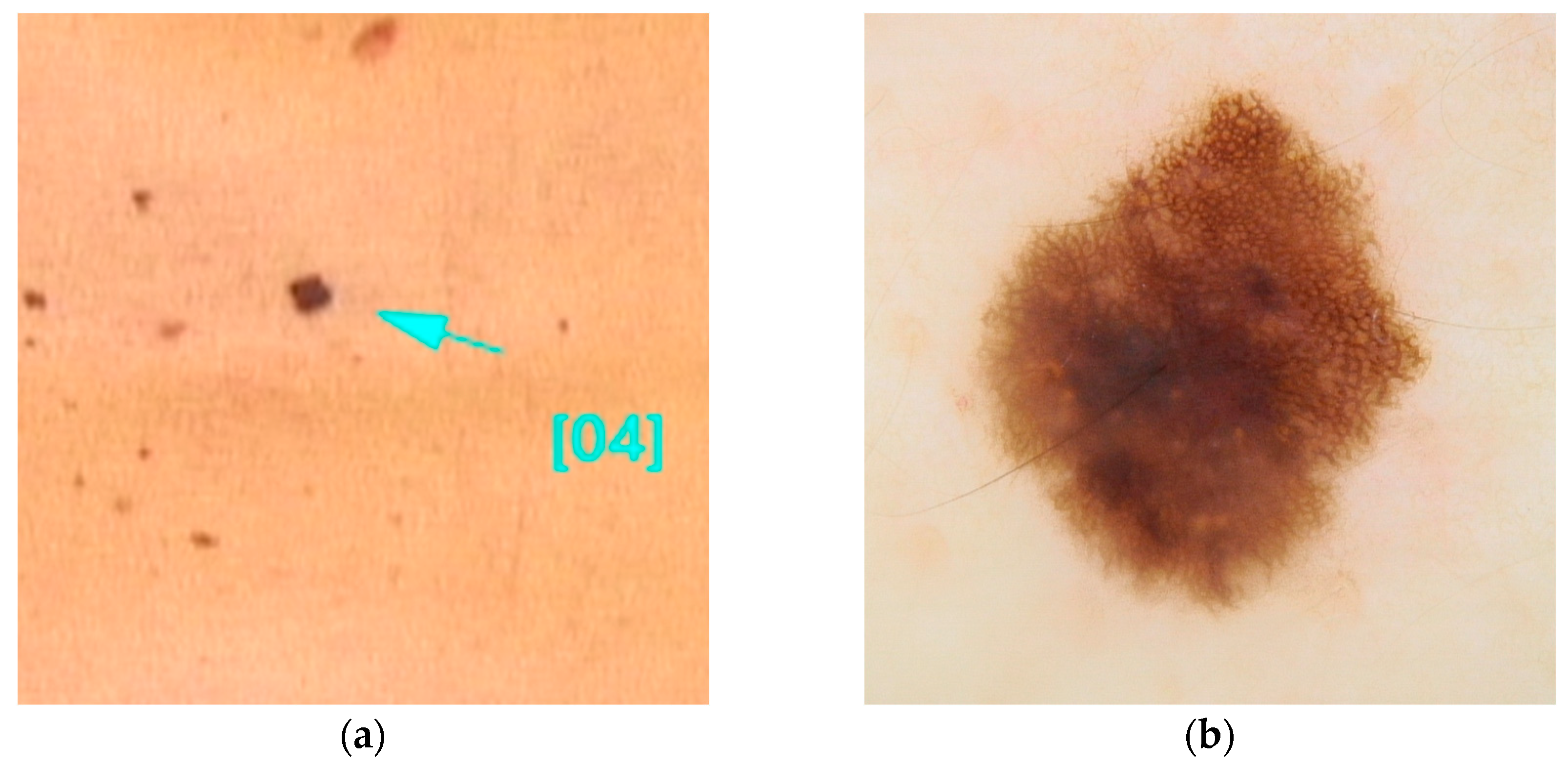 Diseases 13 00180 g003