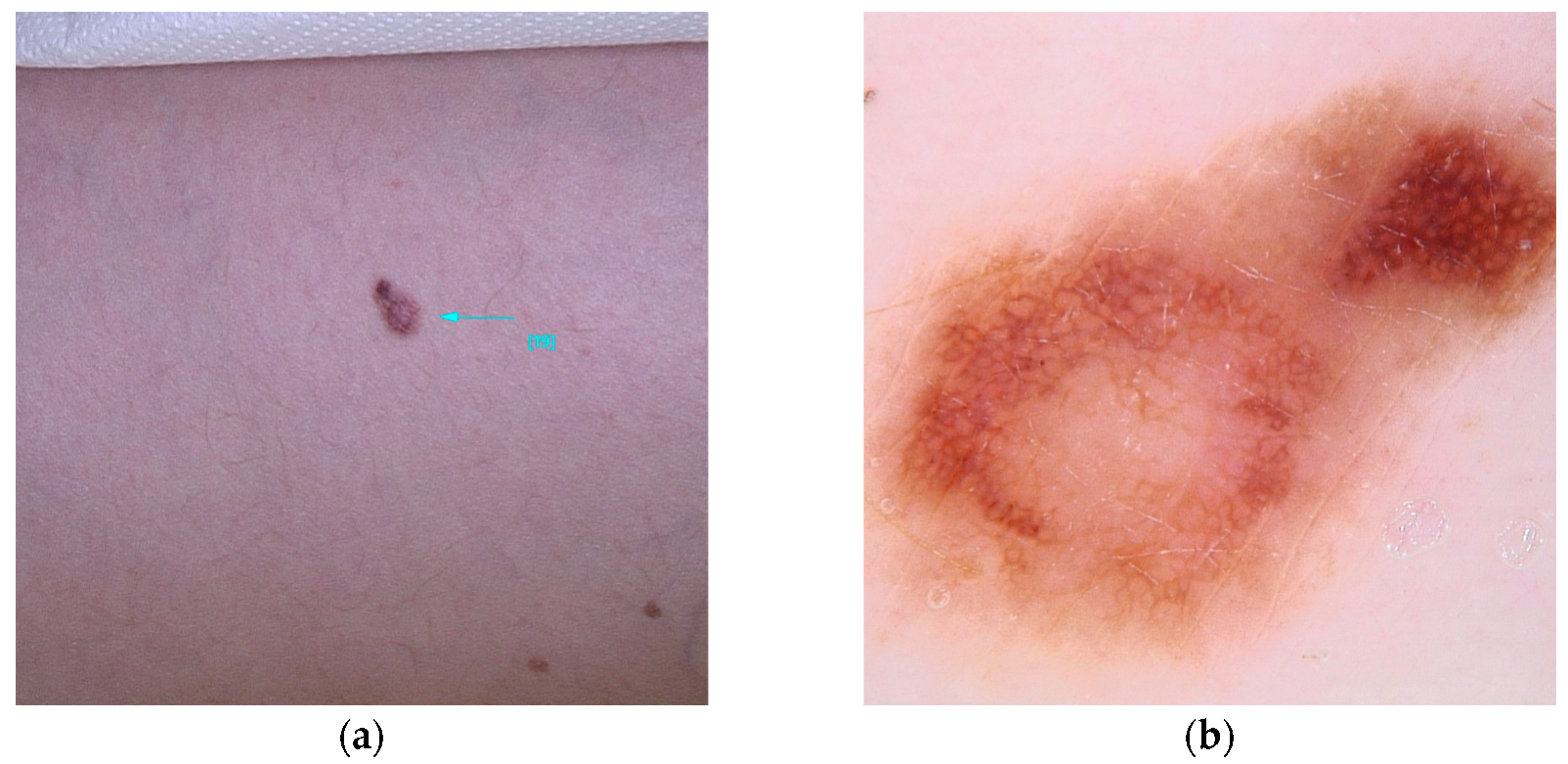 Diseases 13 00180 g004