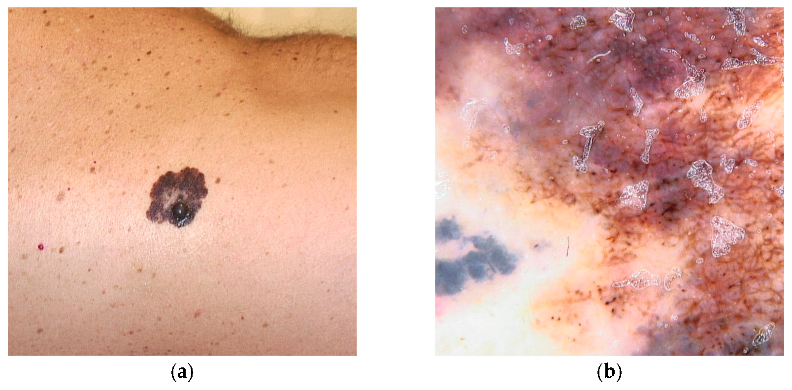 Diseases 13 00180 g007