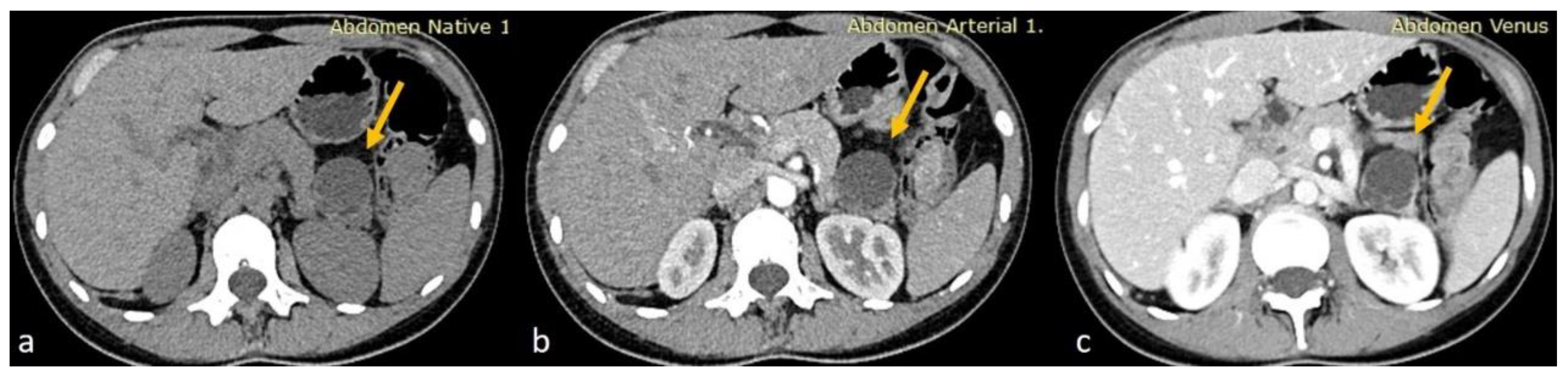 Diseases 13 00203 g001