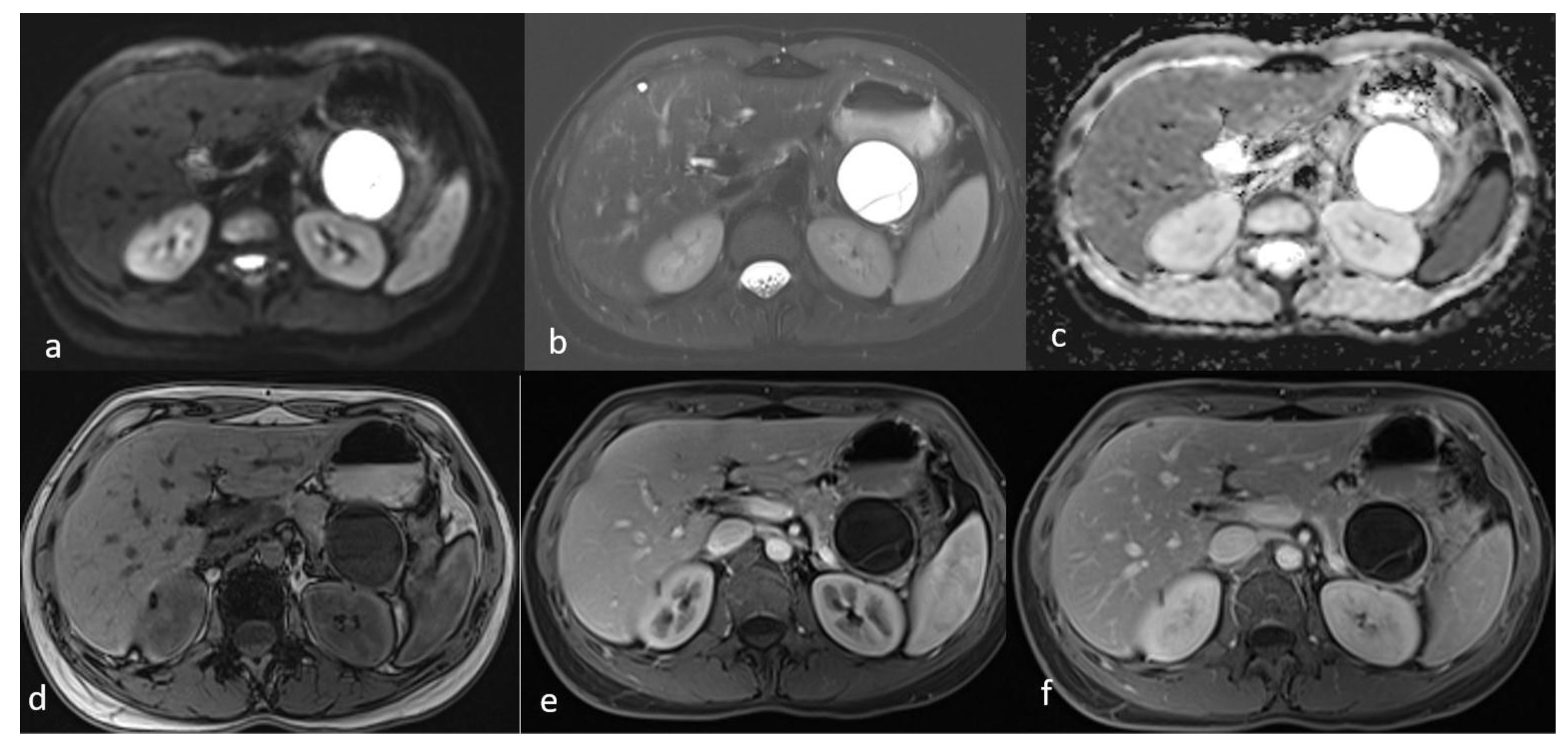 Diseases 13 00203 g004