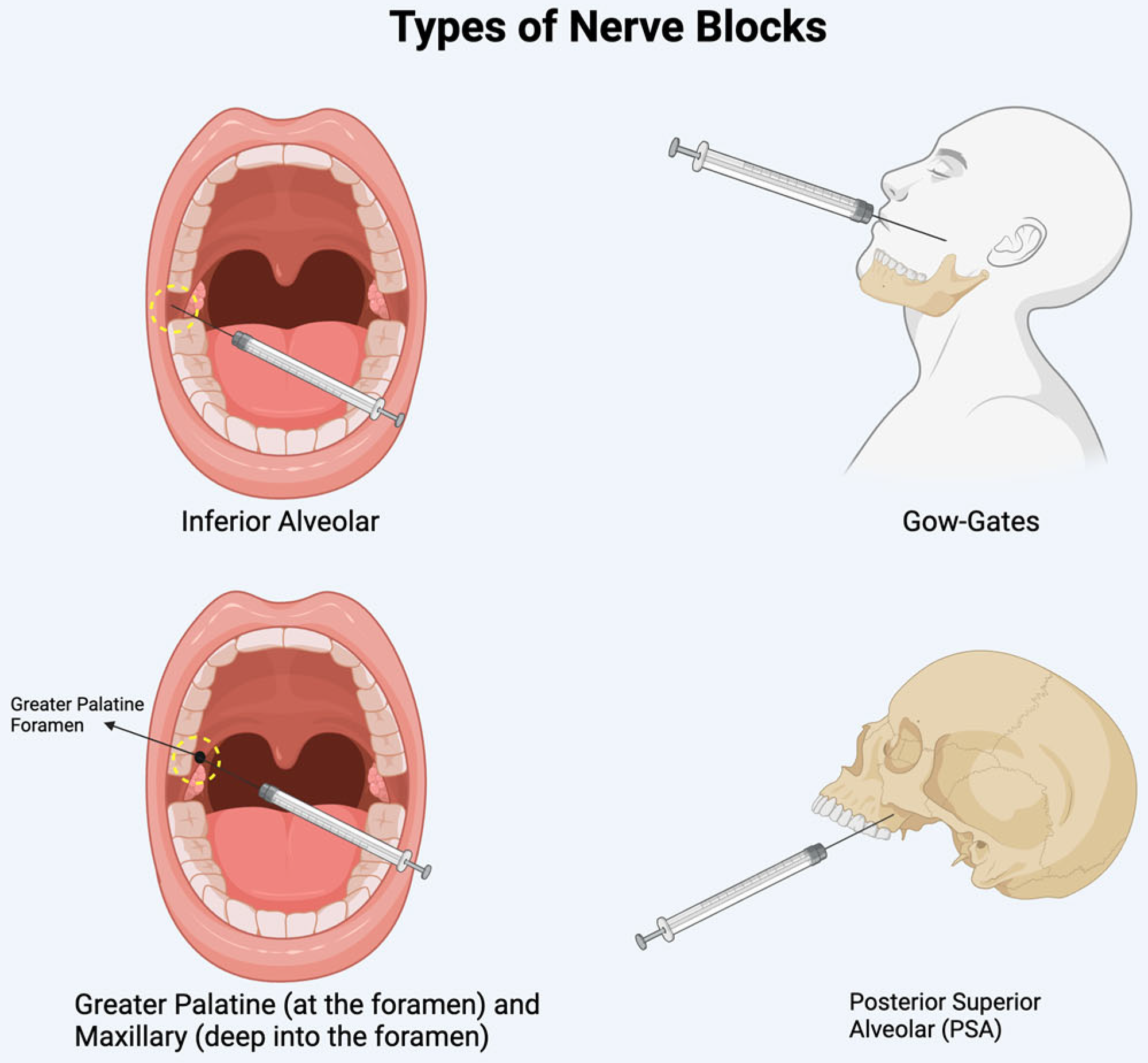 Diseases 13 00244 g004 Diseases 13 00244 g004
