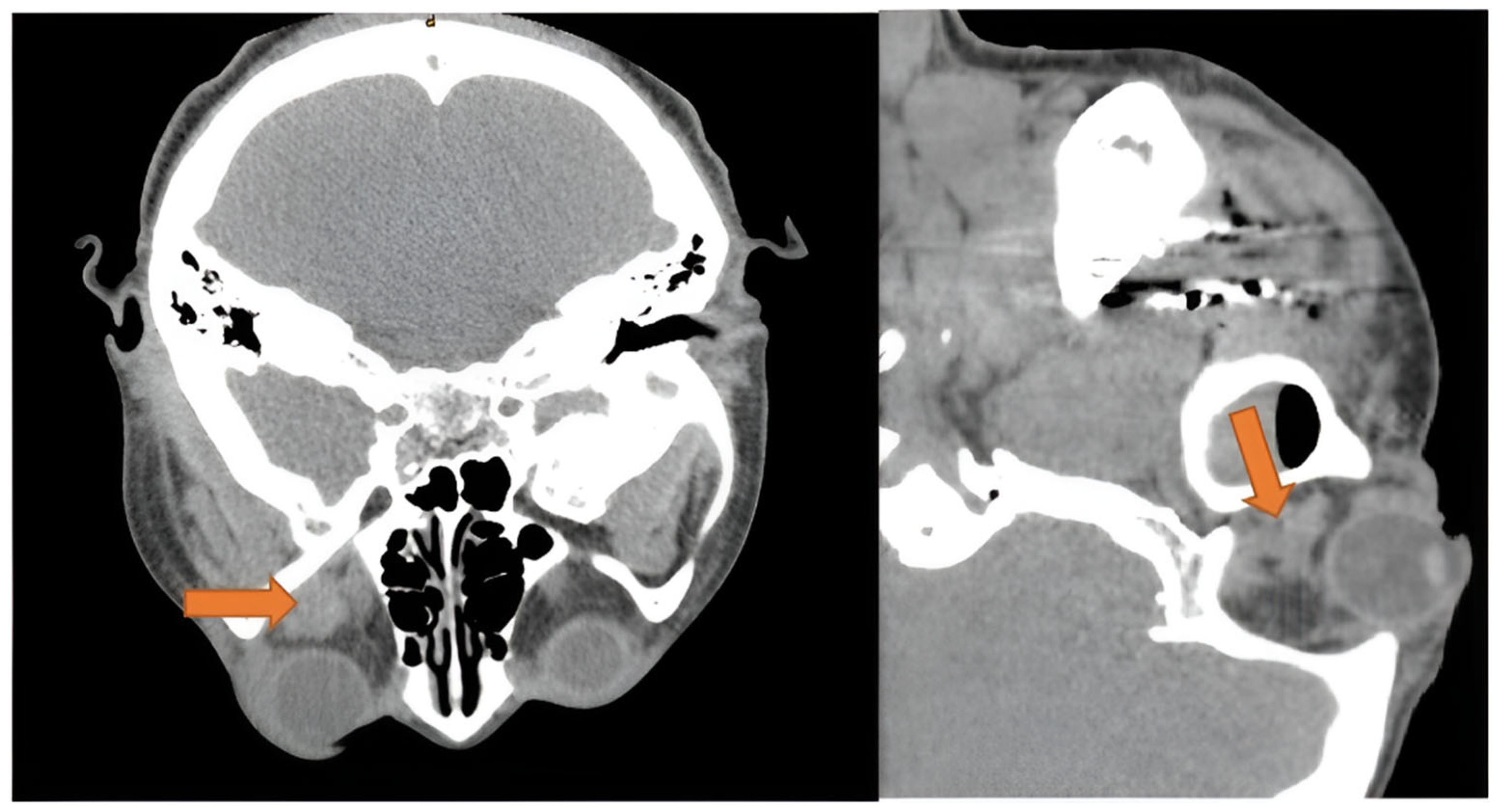 Diseases 13 00244 g005 Diseases 13 00244 g005