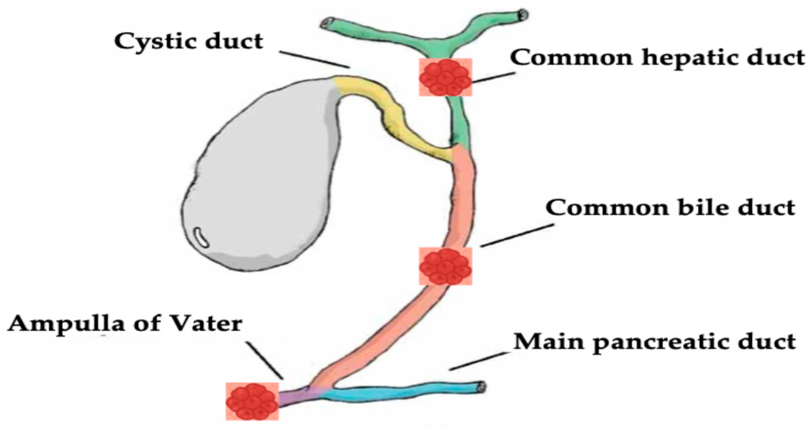 yu Endobiliary Radiofrequency Ablation for Hepato-Biliary