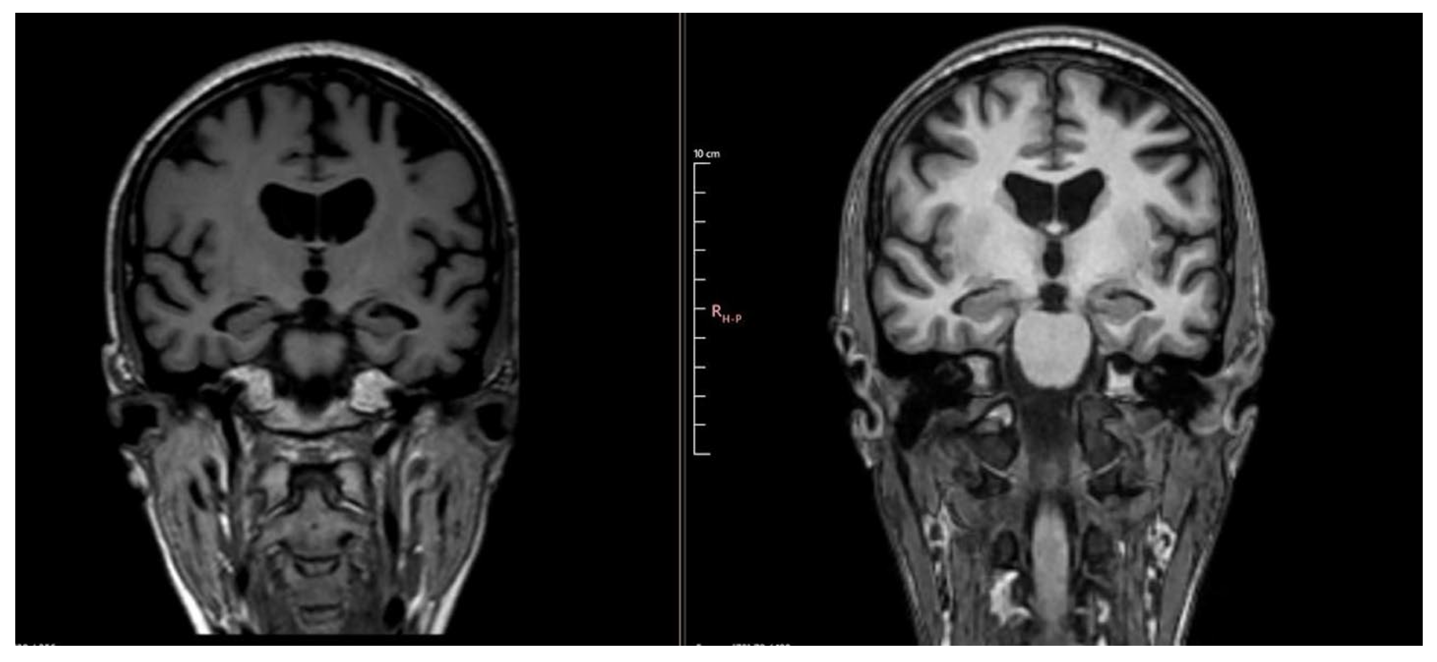 Diseases 13 00310 g003