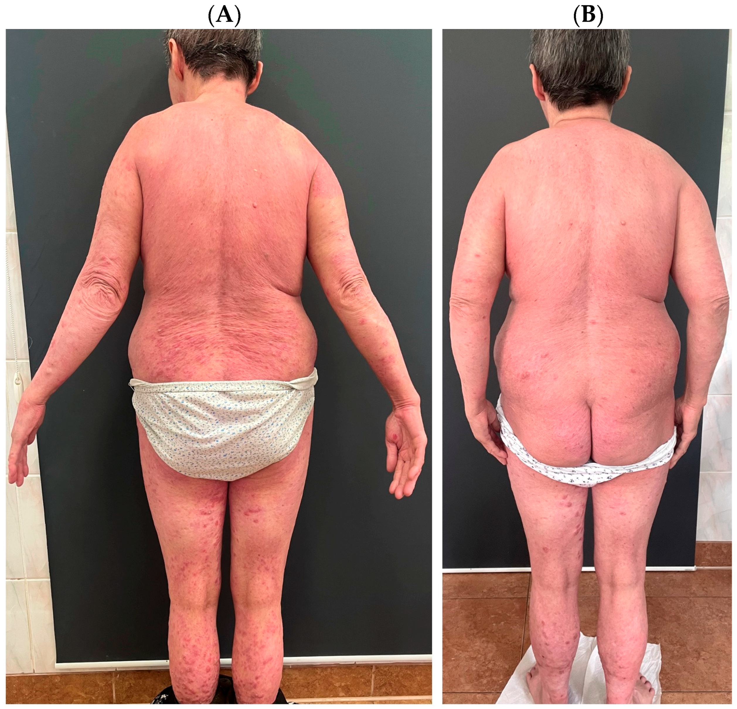 Diseases 13 00322 g001