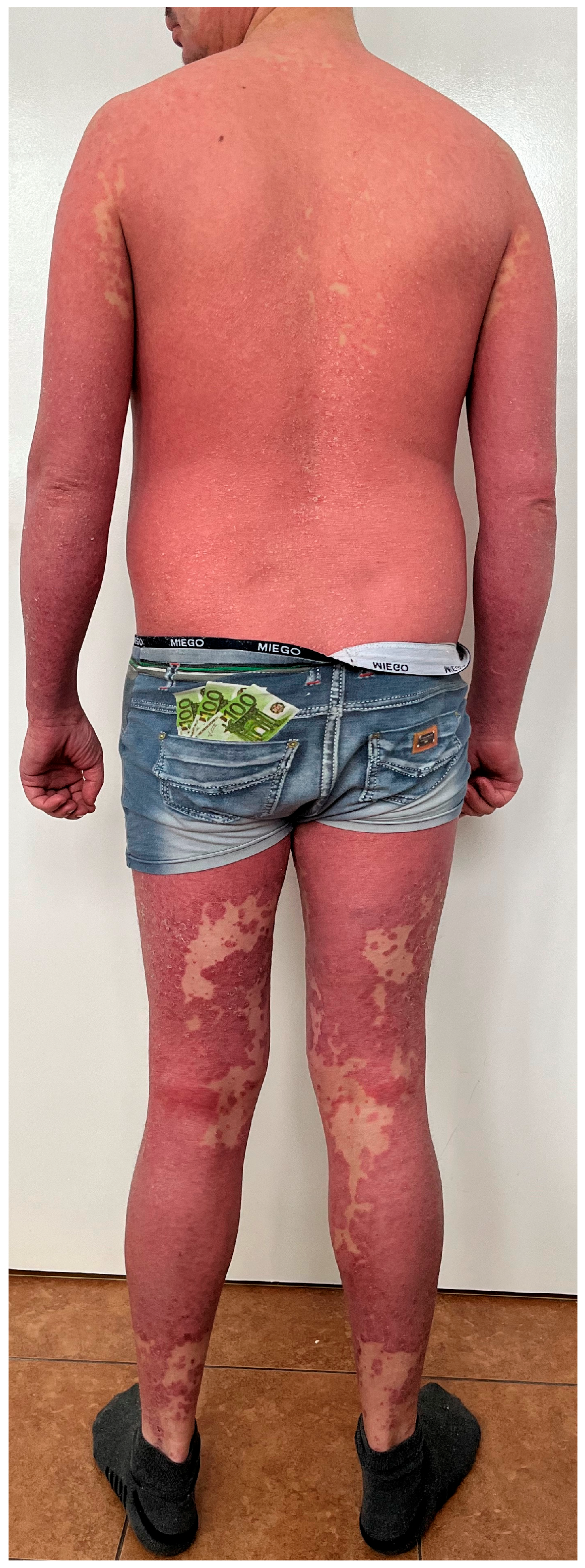 Diseases 13 00322 g002