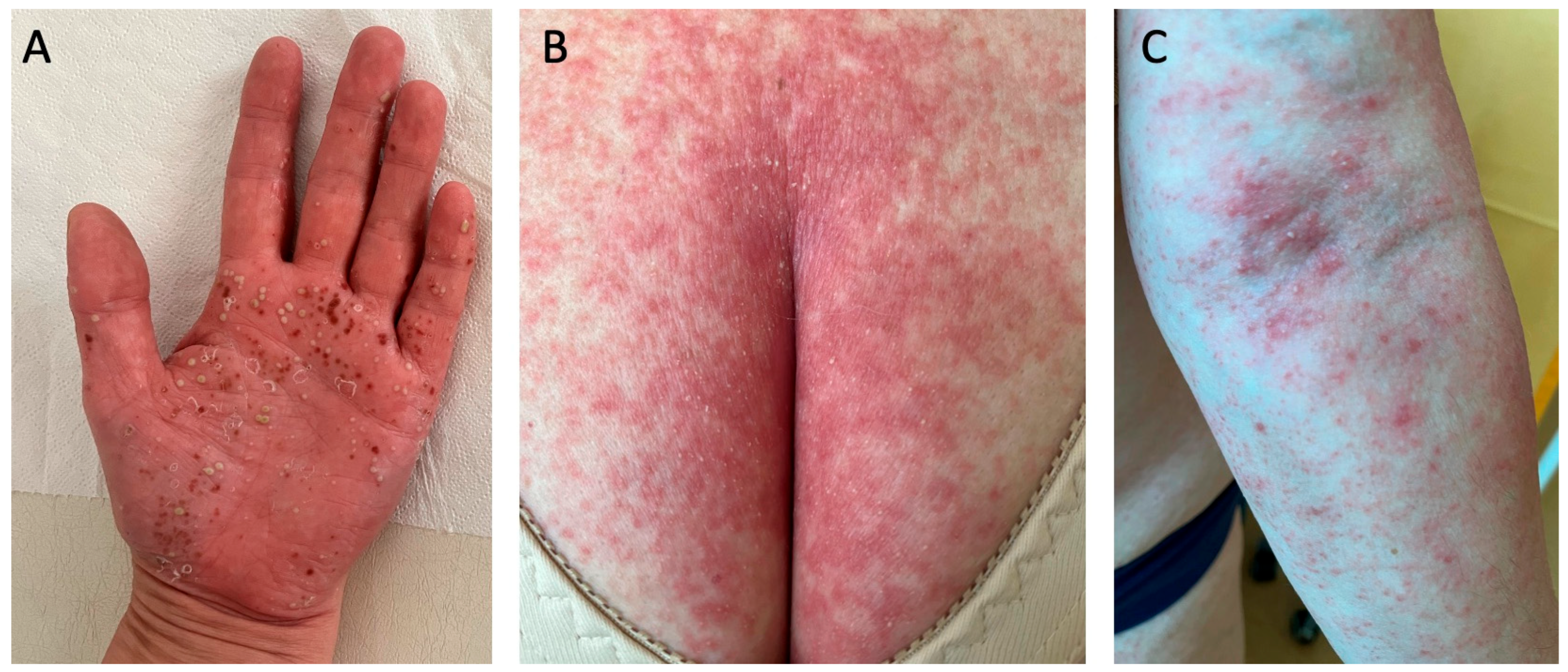 Diseases 13 00322 g003