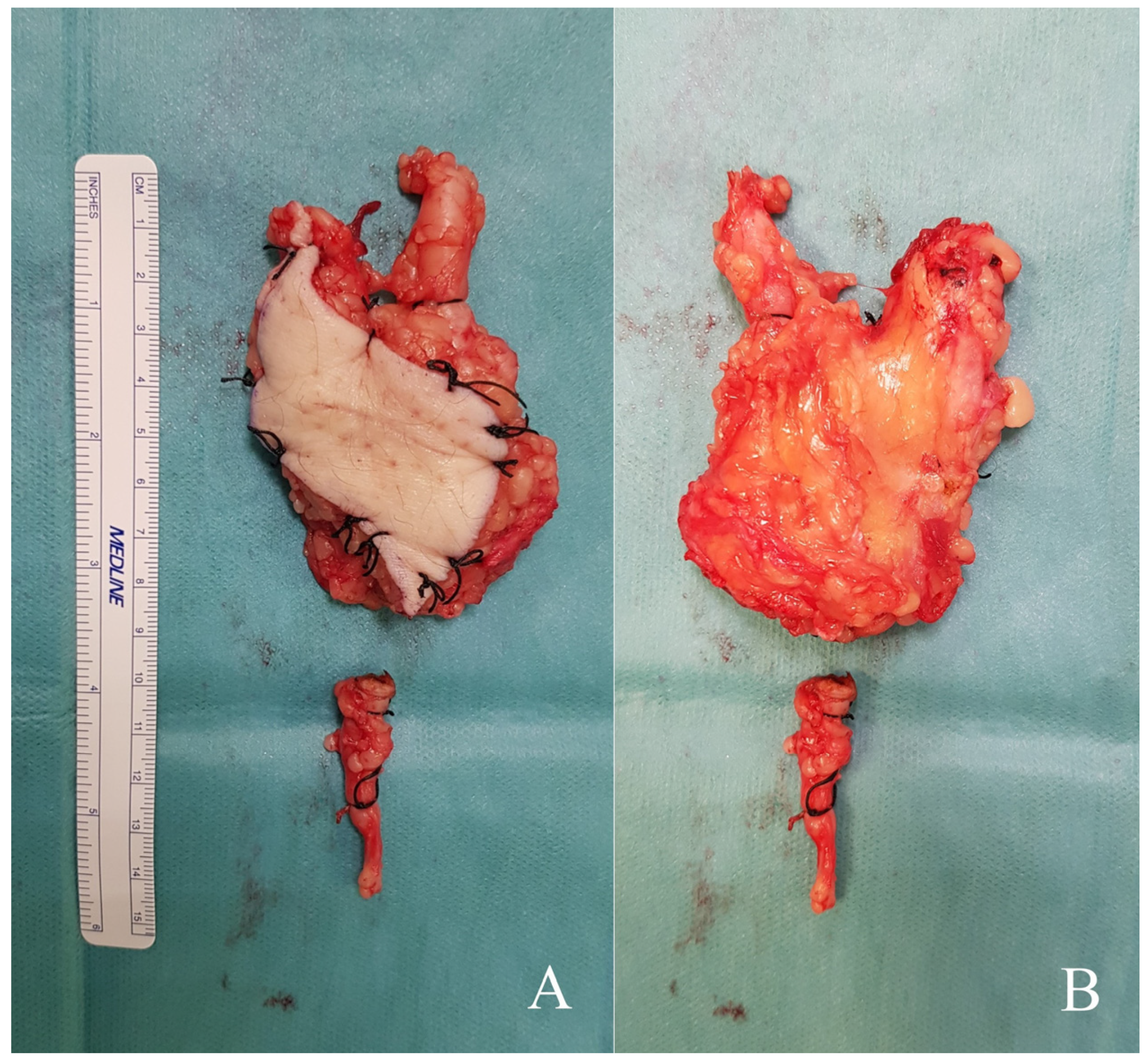 Diseases 13 00330 g005