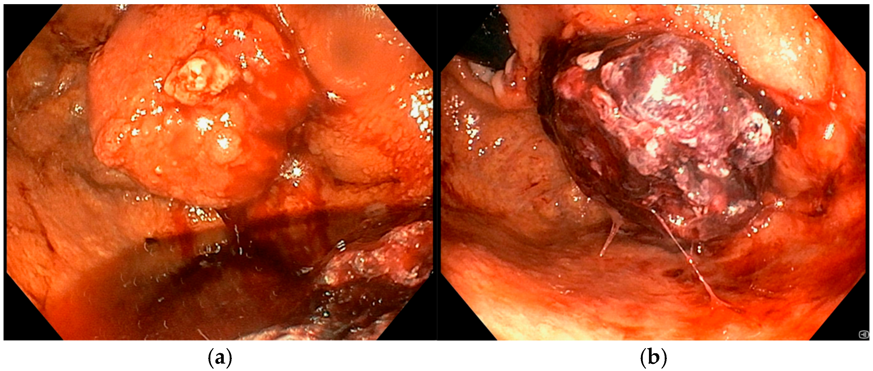 Diseases 13 00340 g005