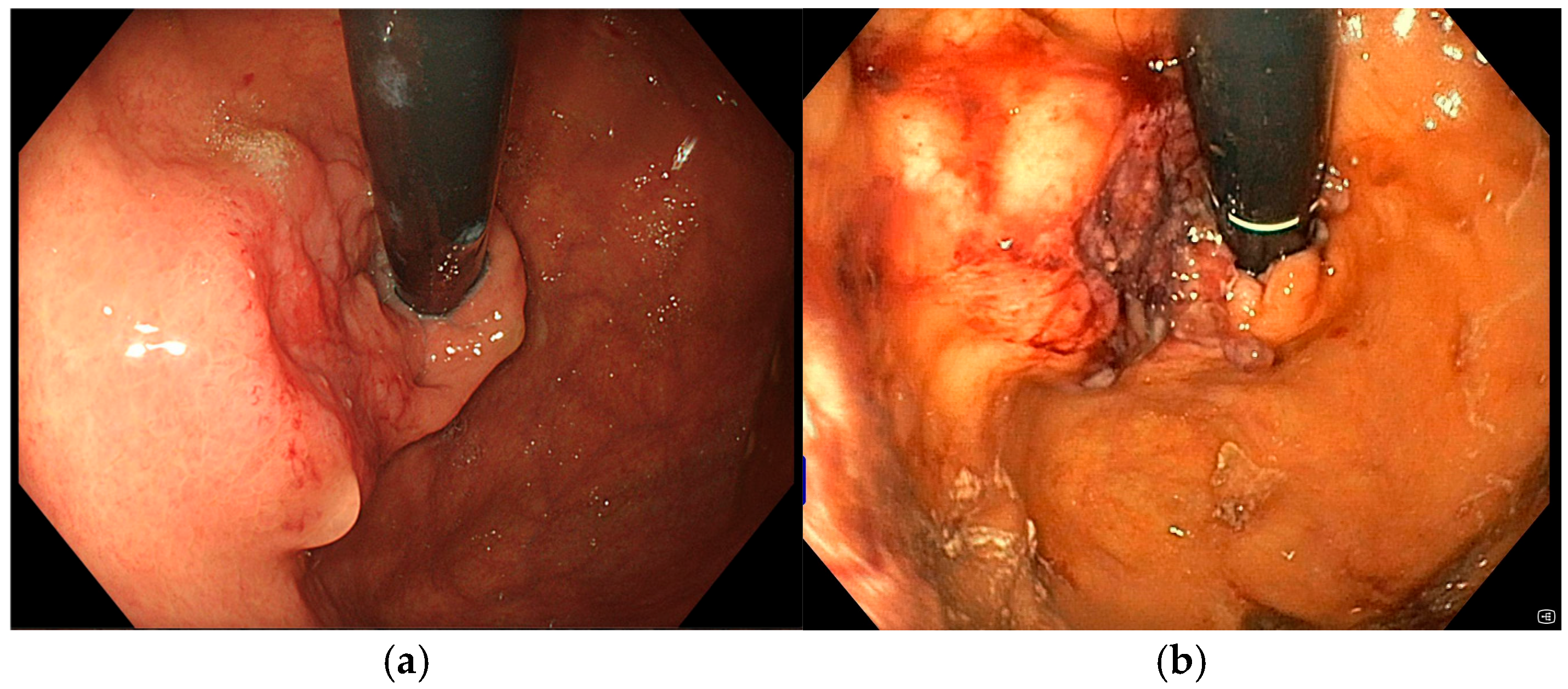 Diseases 13 00340 g007