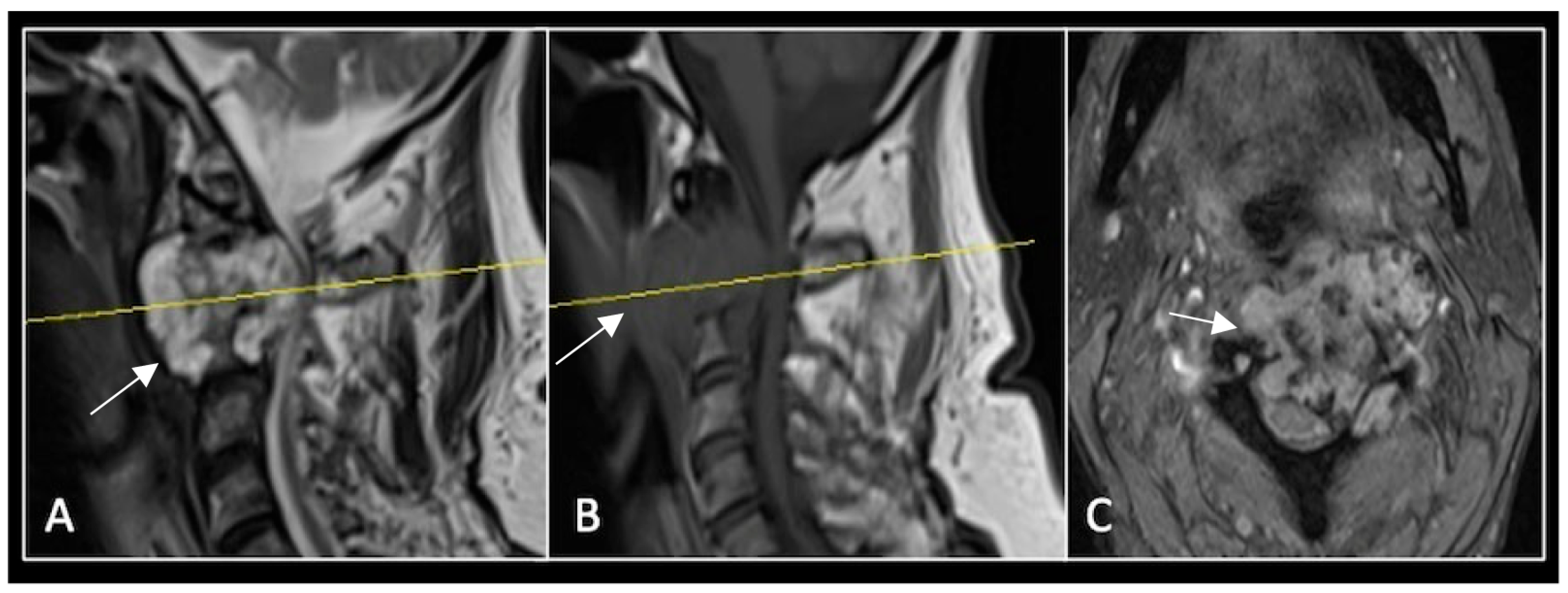 Diseases 13 00348 g002 Diseases 13 00348 g002