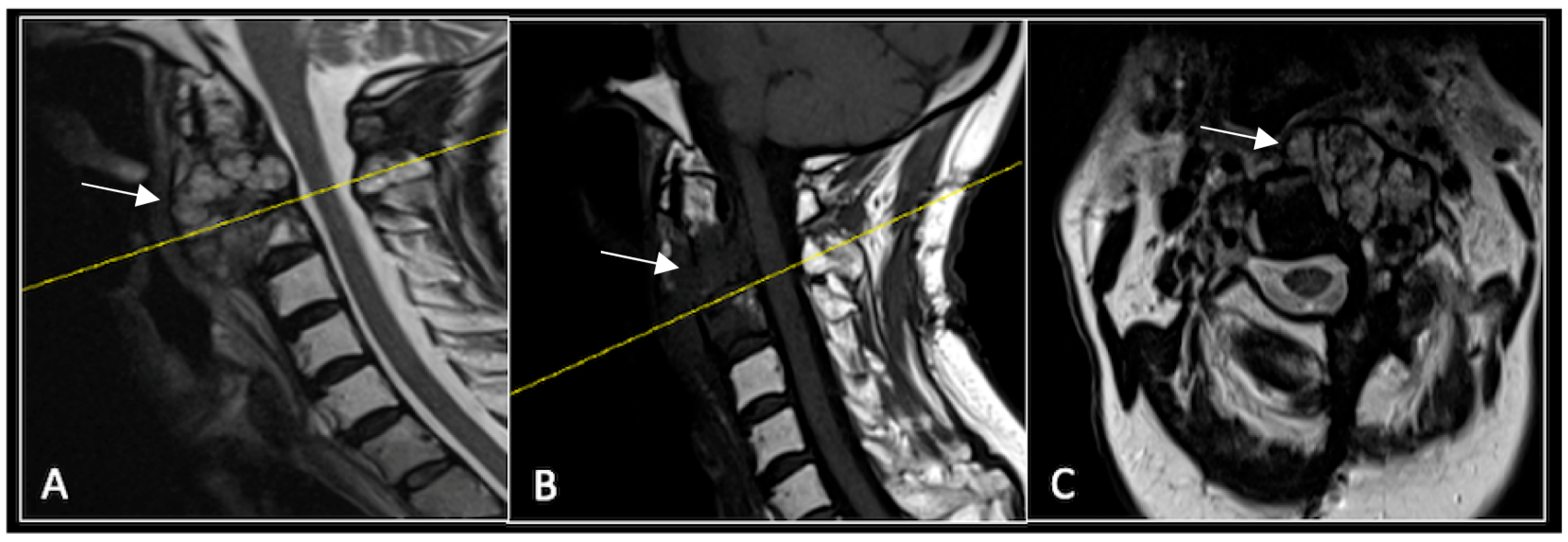 Diseases 13 00348 g010 Diseases 13 00348 g010