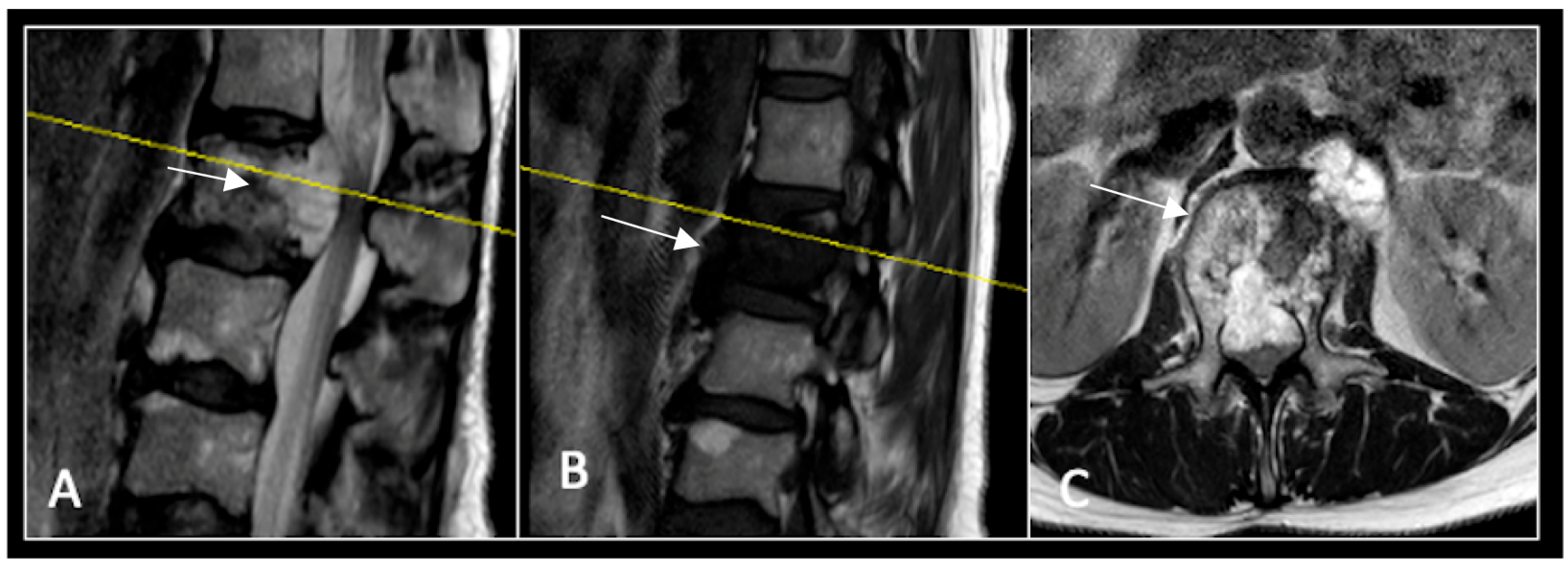 Diseases 13 00348 g011 Diseases 13 00348 g011