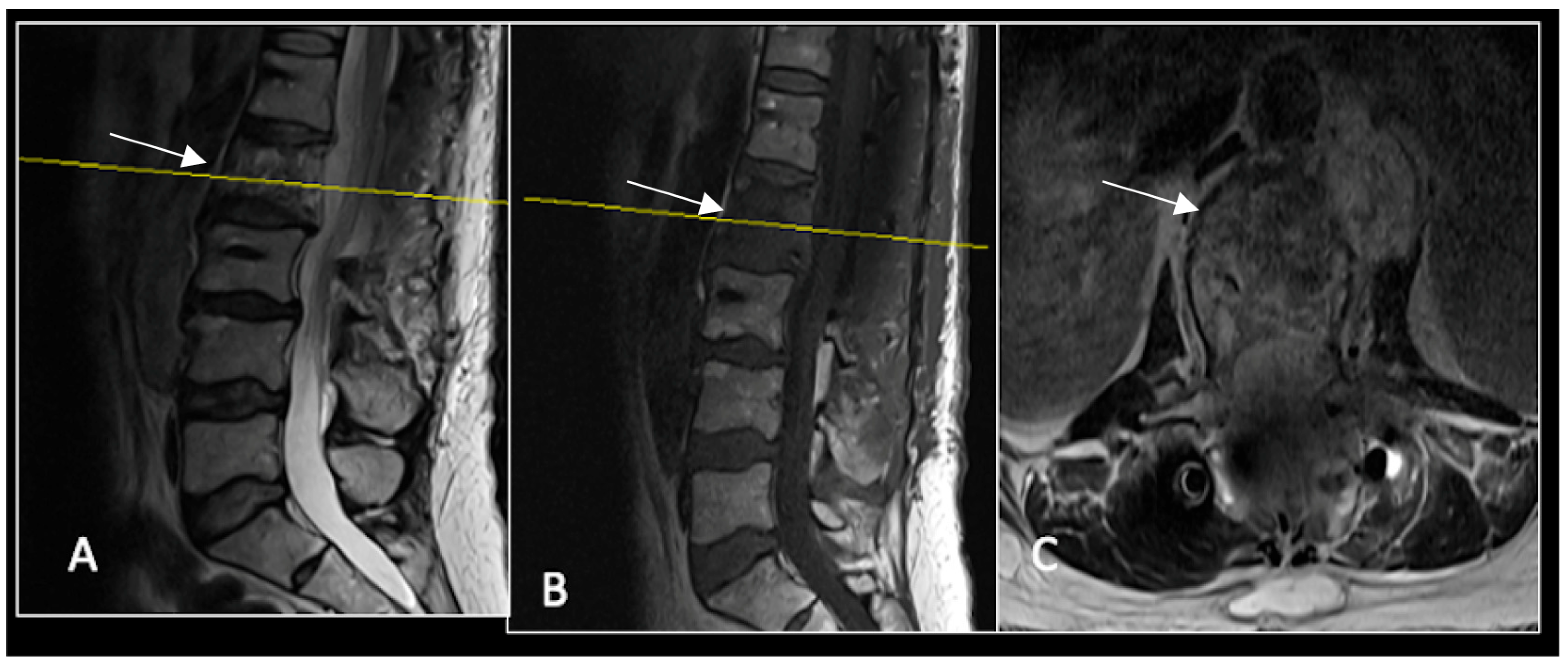 Diseases 13 00348 g013 Diseases 13 00348 g013