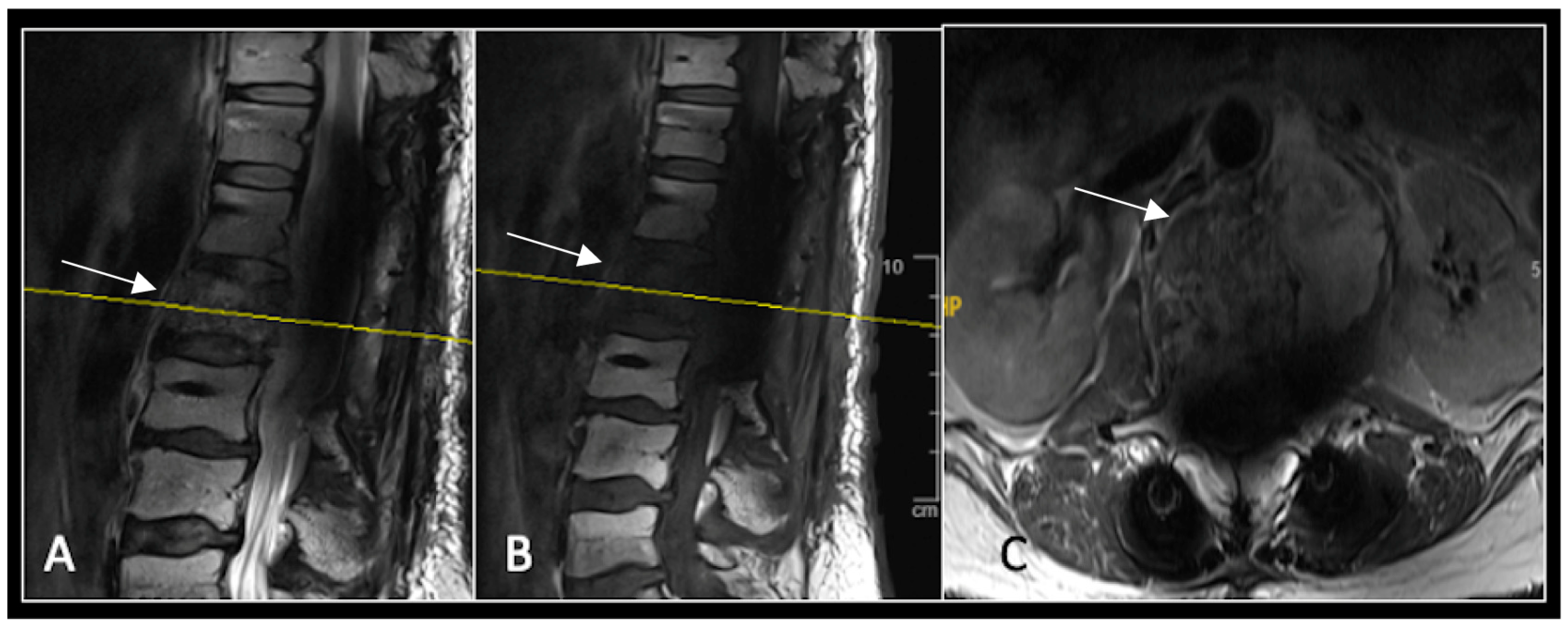 Diseases 13 00348 g014 Diseases 13 00348 g014