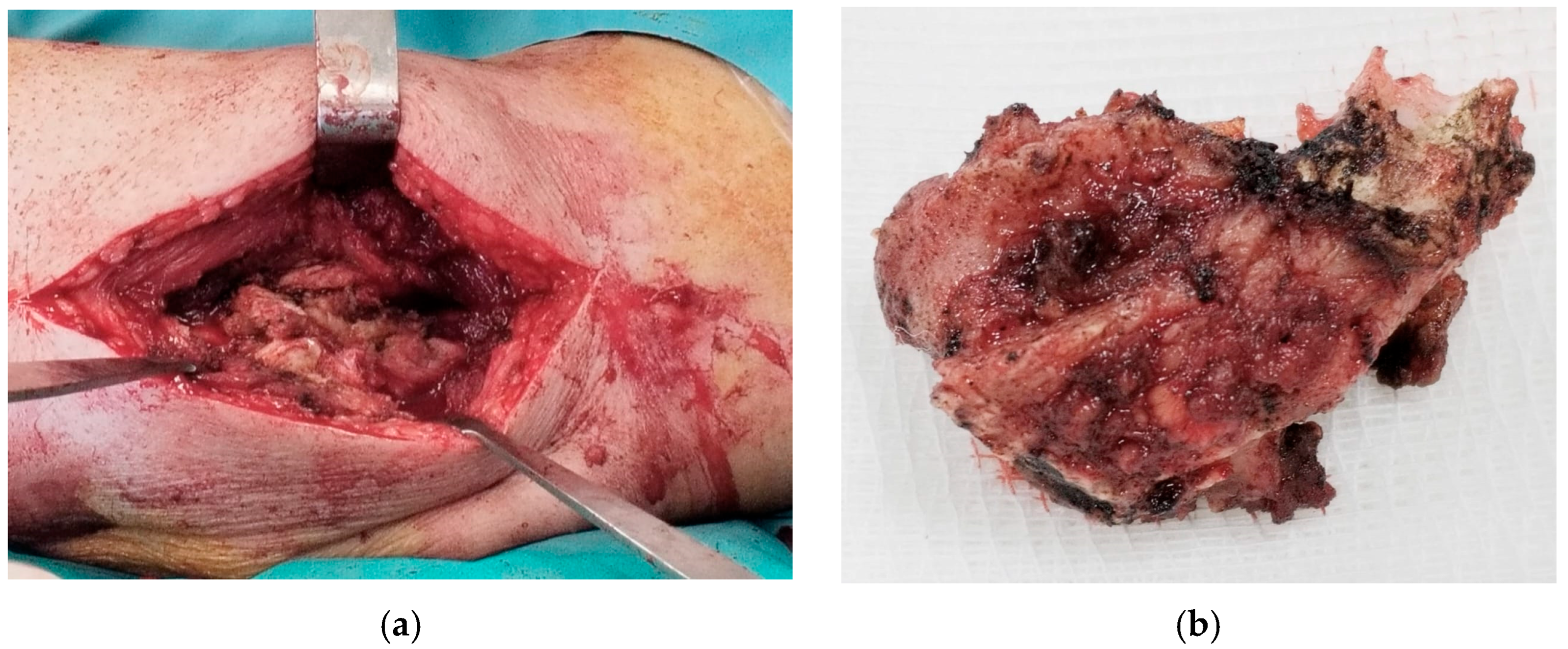 Diseases 13 00369 g003