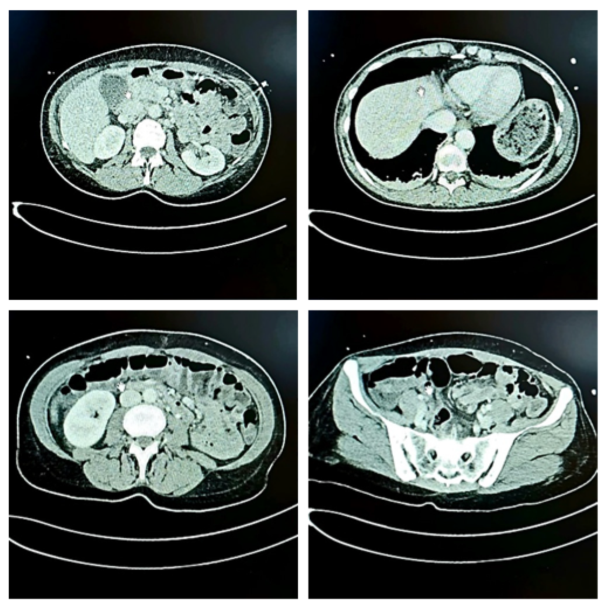 Diseases 13 00376 g002 Diseases 13 00376 g002