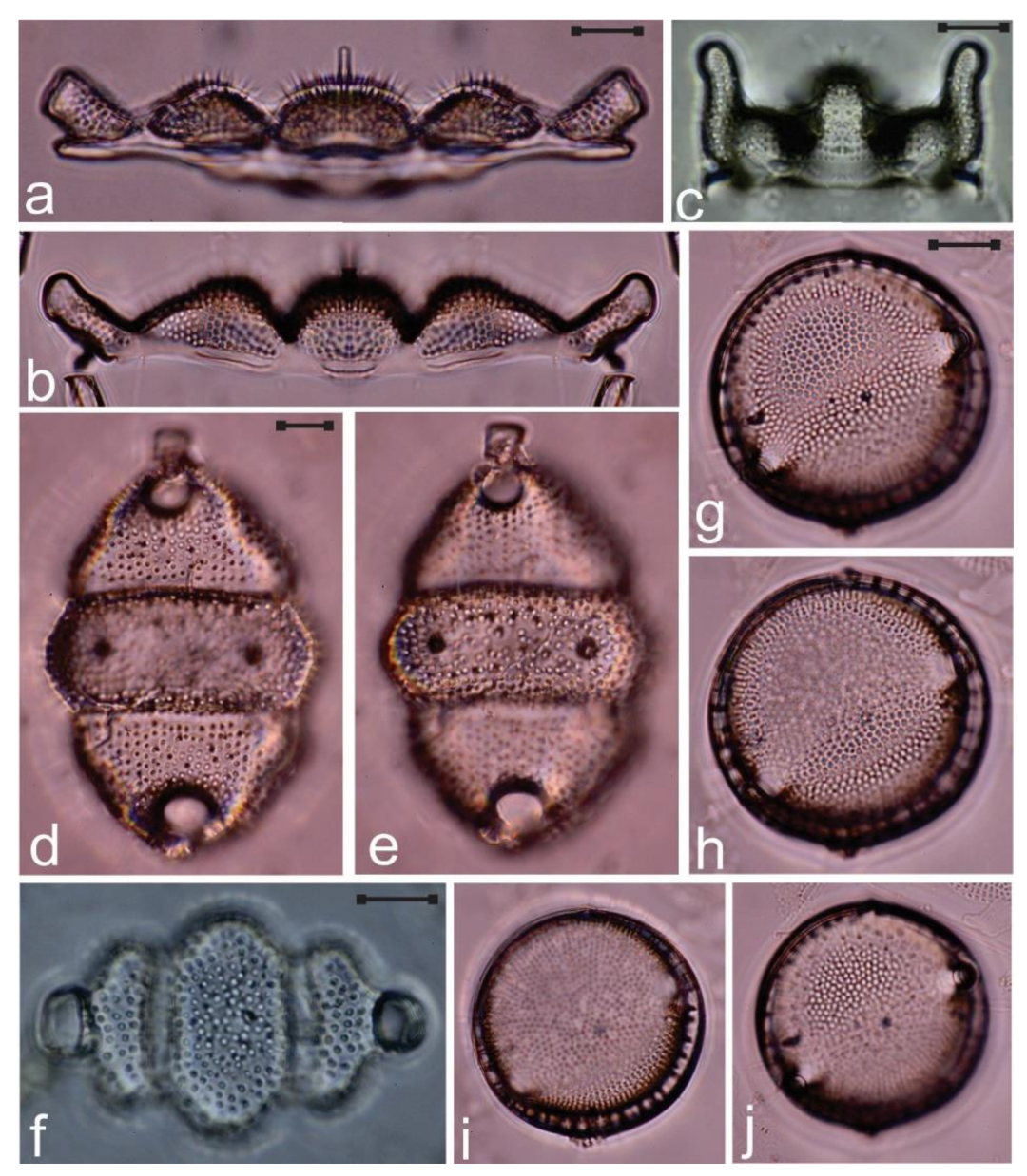 Diversity Free Full Text Species Composition And New Records Of Diatom Taxa On Phyllodictyon Pulcherrimum Chlorophyceae From The Gulf Of California Html Diversity Free Full Text Species Composition And New Records Of Diatom Taxa On Phyllodictyon Pulcherrimum Chlorophyceae From The Gulf Of California Html