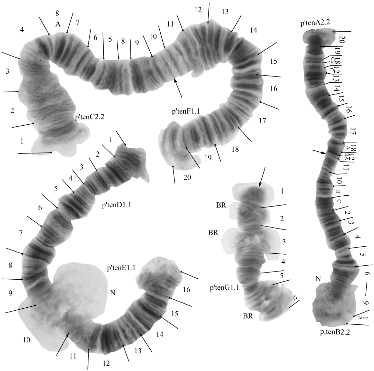 Karyotype characteristics and polymorphism peculiarities of Chironomus  bernensis Wülker & Klötzli, 1973 (Diptera, Chironomidae) from the Central  Caucasus and Ciscaucasia