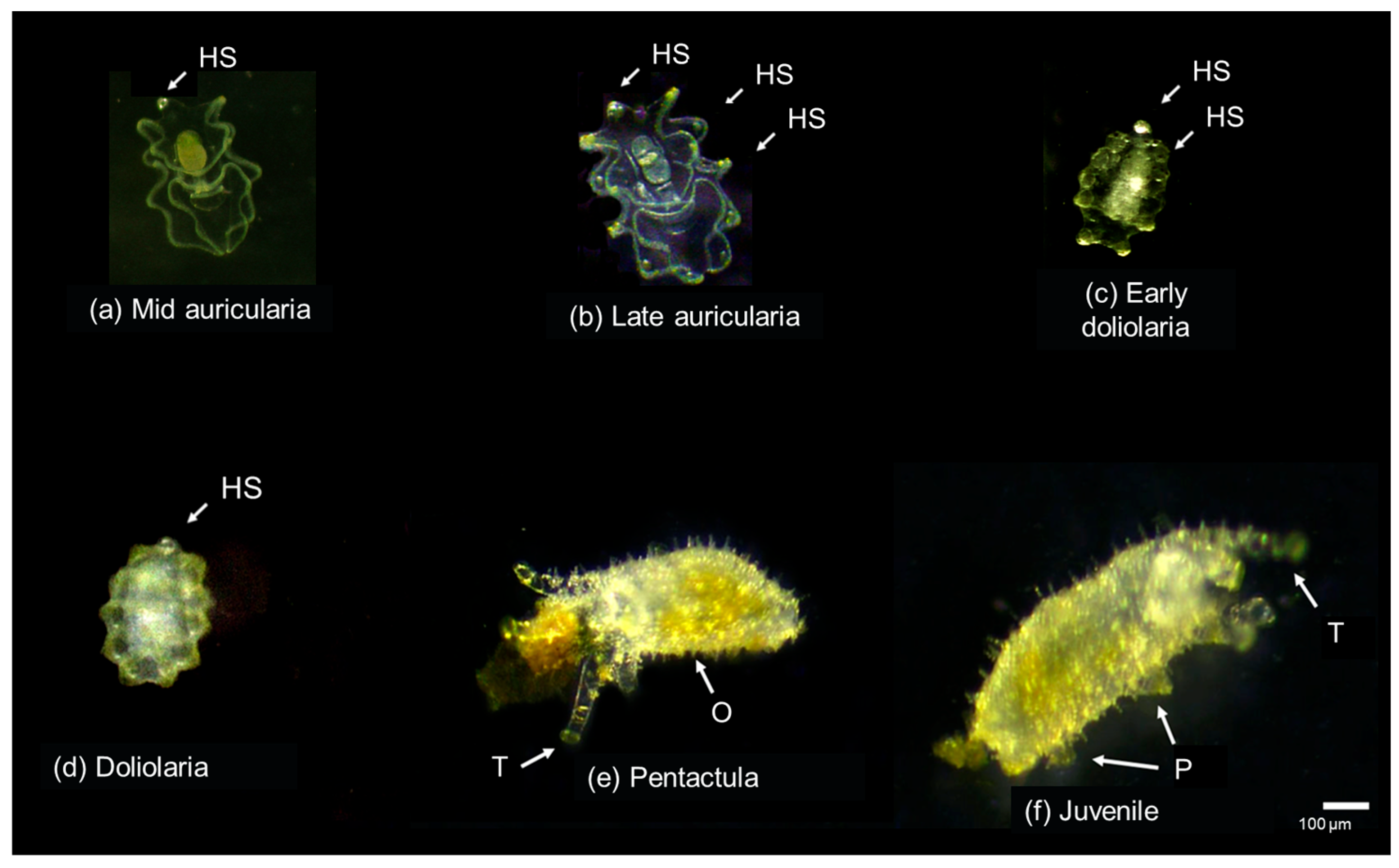 Effect of Different Algal Biofilms on the Larval Settlement of the