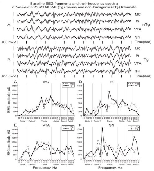 Baseline Electroencephalogram and Its Evolution after Activation