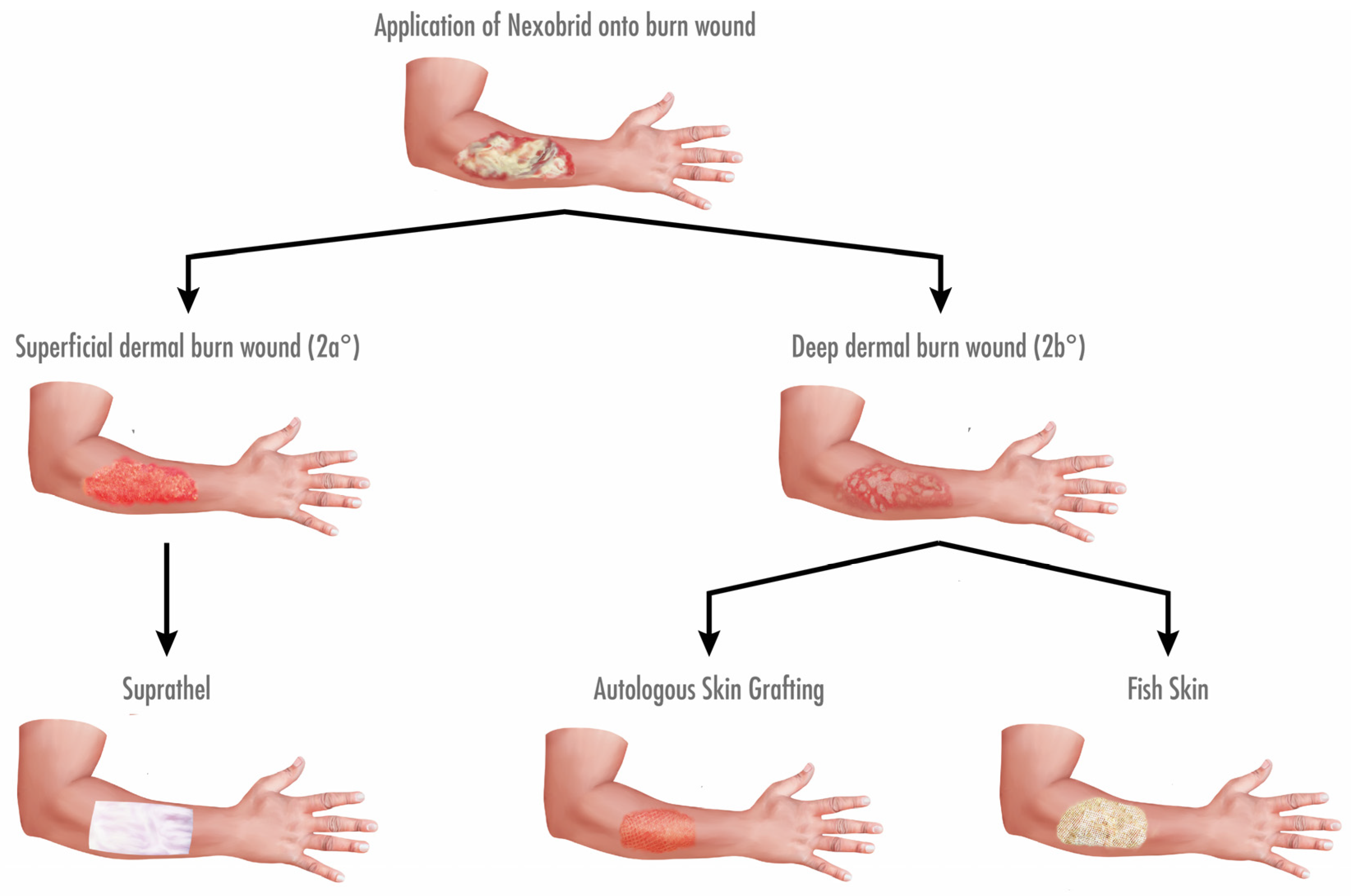 Fish online wound care