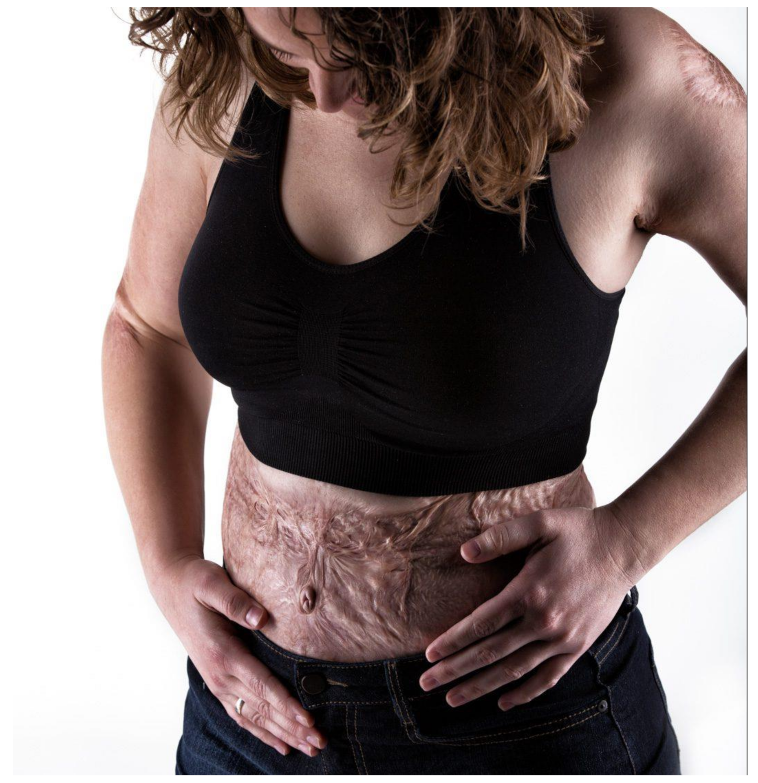 Ebj 04 00005 g0a1 Ebj 04 00005 g0a1