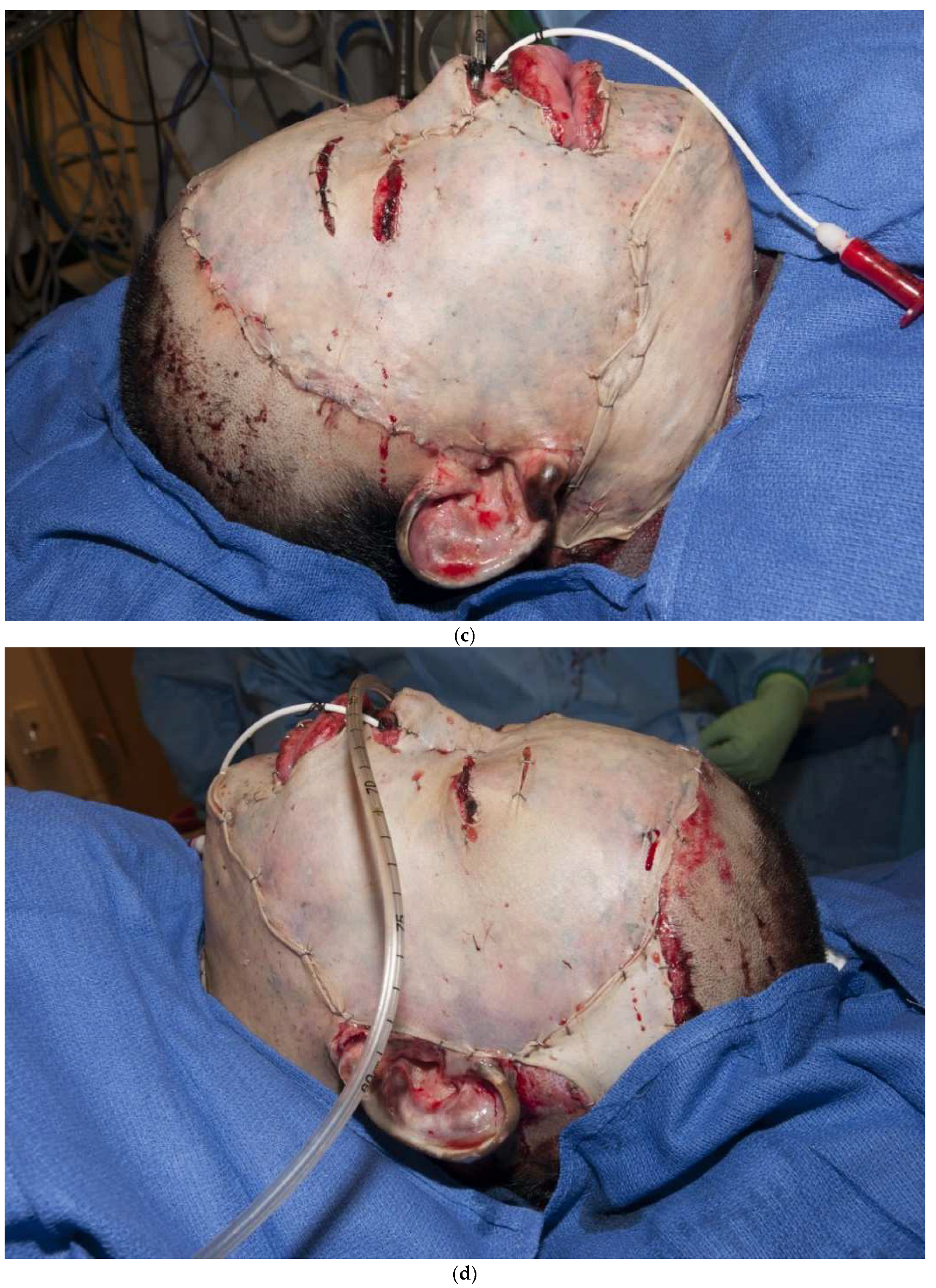 Ebj 04 00024 g003b Ebj 04 00024 g003b