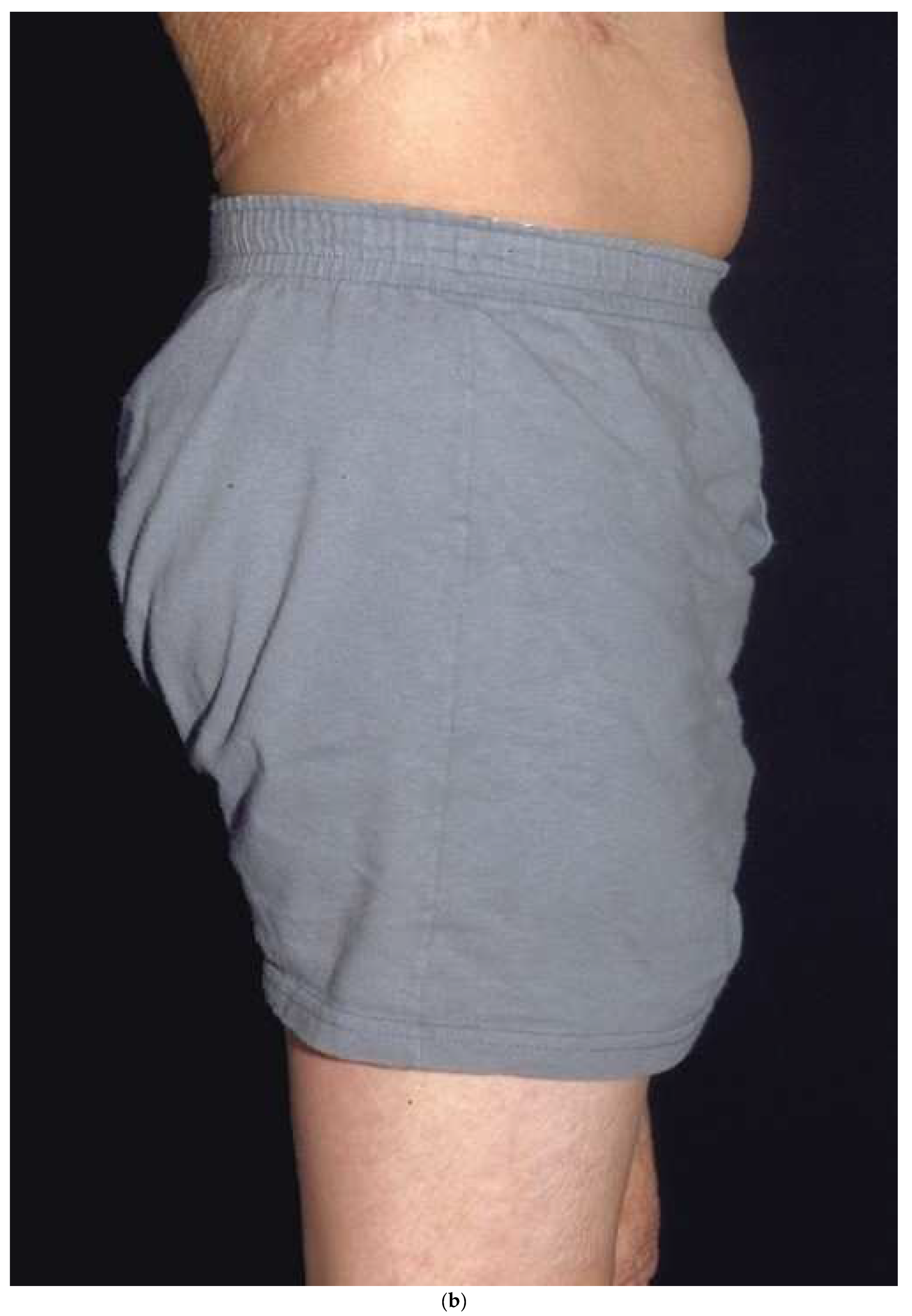 Ebj 04 00024 g006b Ebj 04 00024 g006b