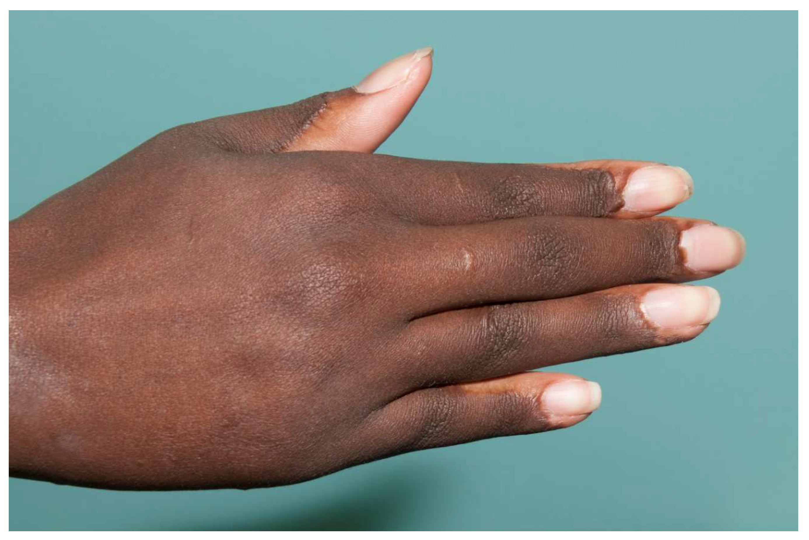 Ebj 04 00024 g008 Ebj 04 00024 g008