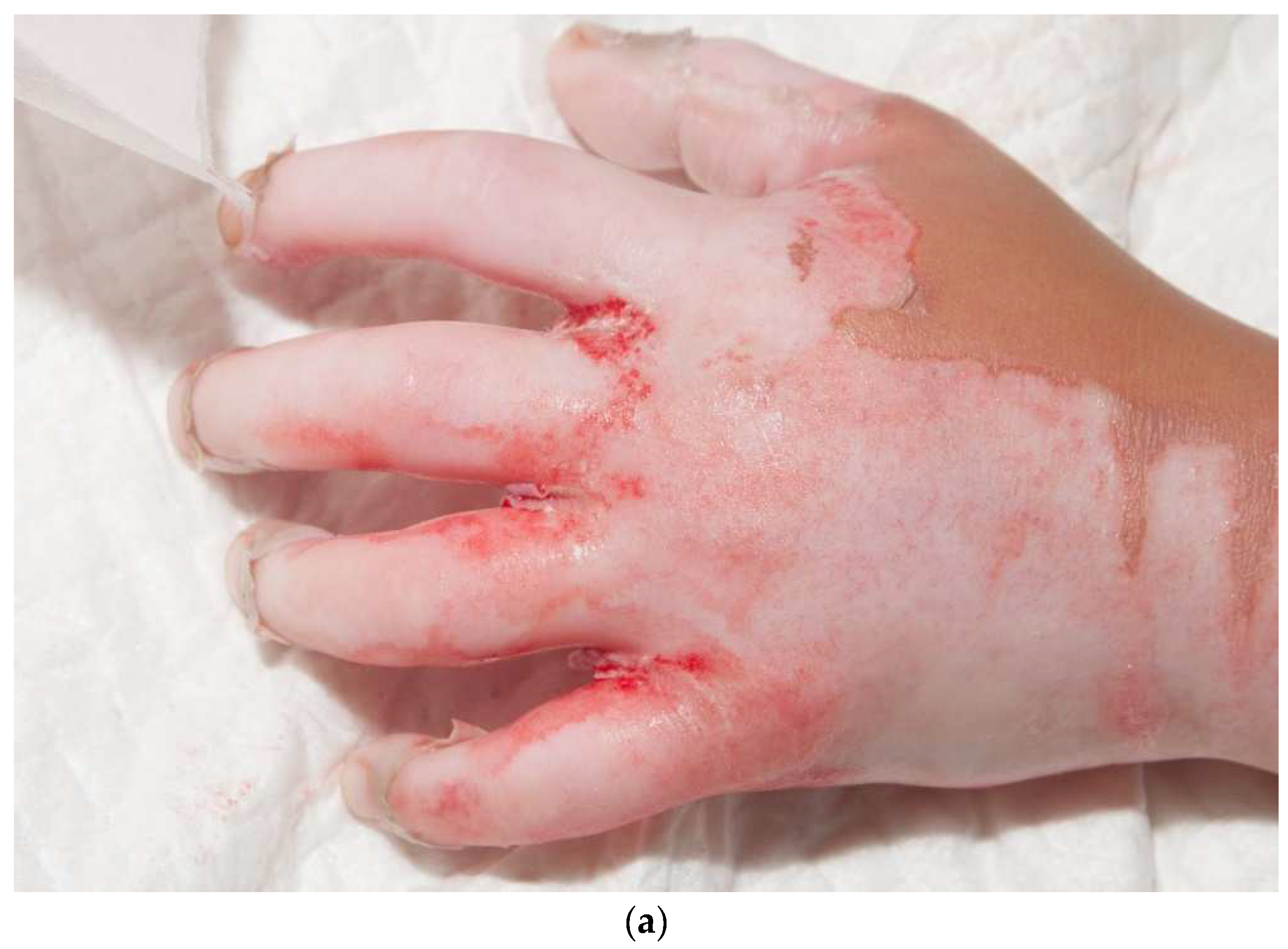 Ebj 04 00024 g009a Ebj 04 00024 g009a