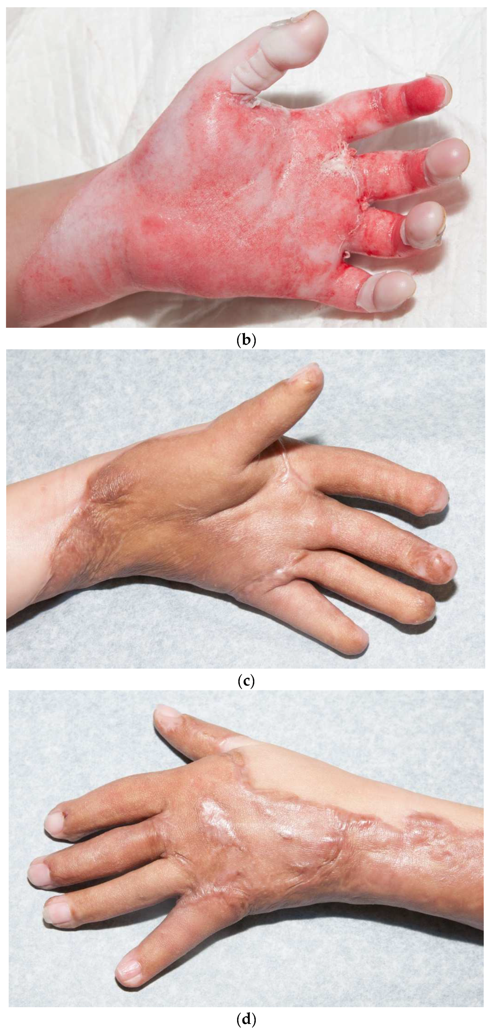 Ebj 04 00024 g009b Ebj 04 00024 g009b