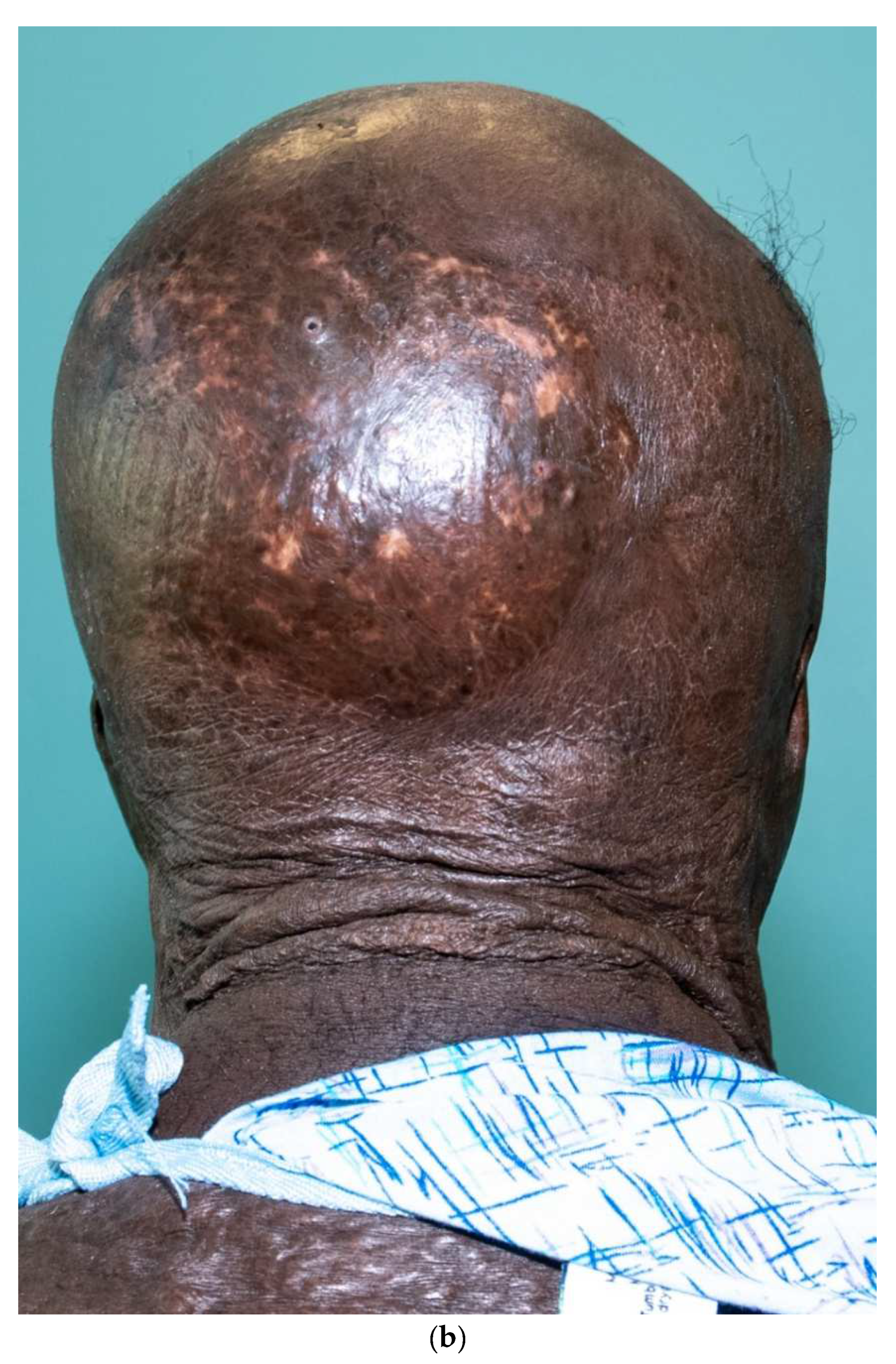 Ebj 04 00024 g010b Ebj 04 00024 g010b