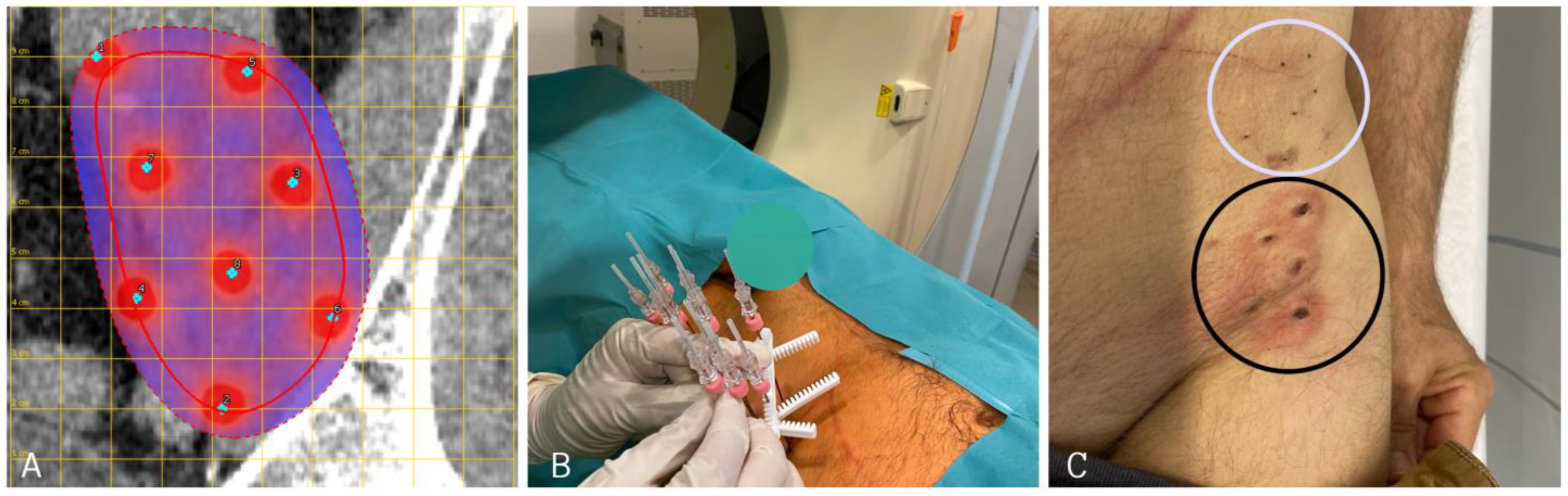 Electrochem 04 00019 g003 Electrochem 04 00019 g003