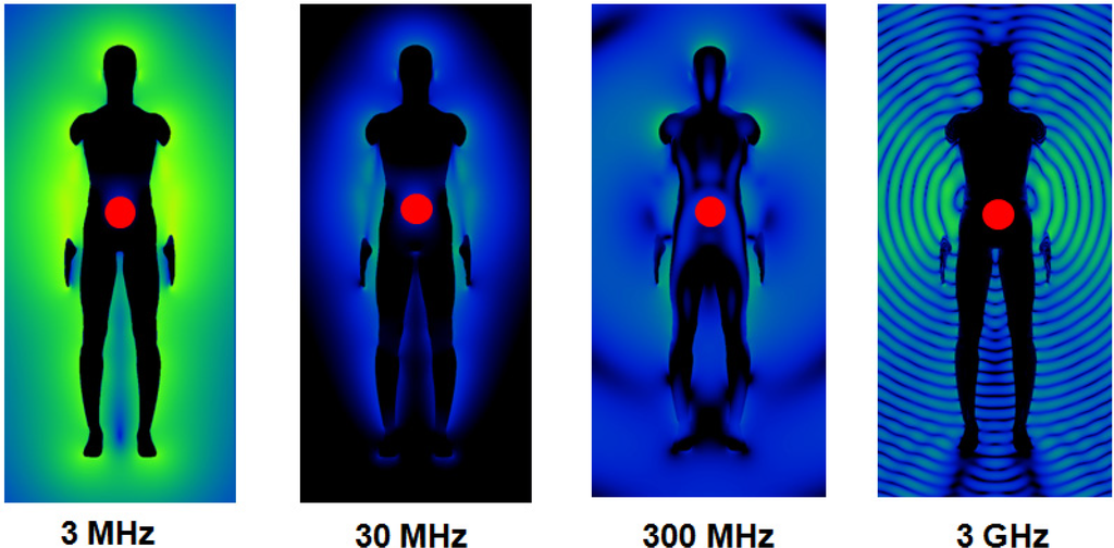 Electronics Free FullText A Compact DualMode Wearable Antenna for