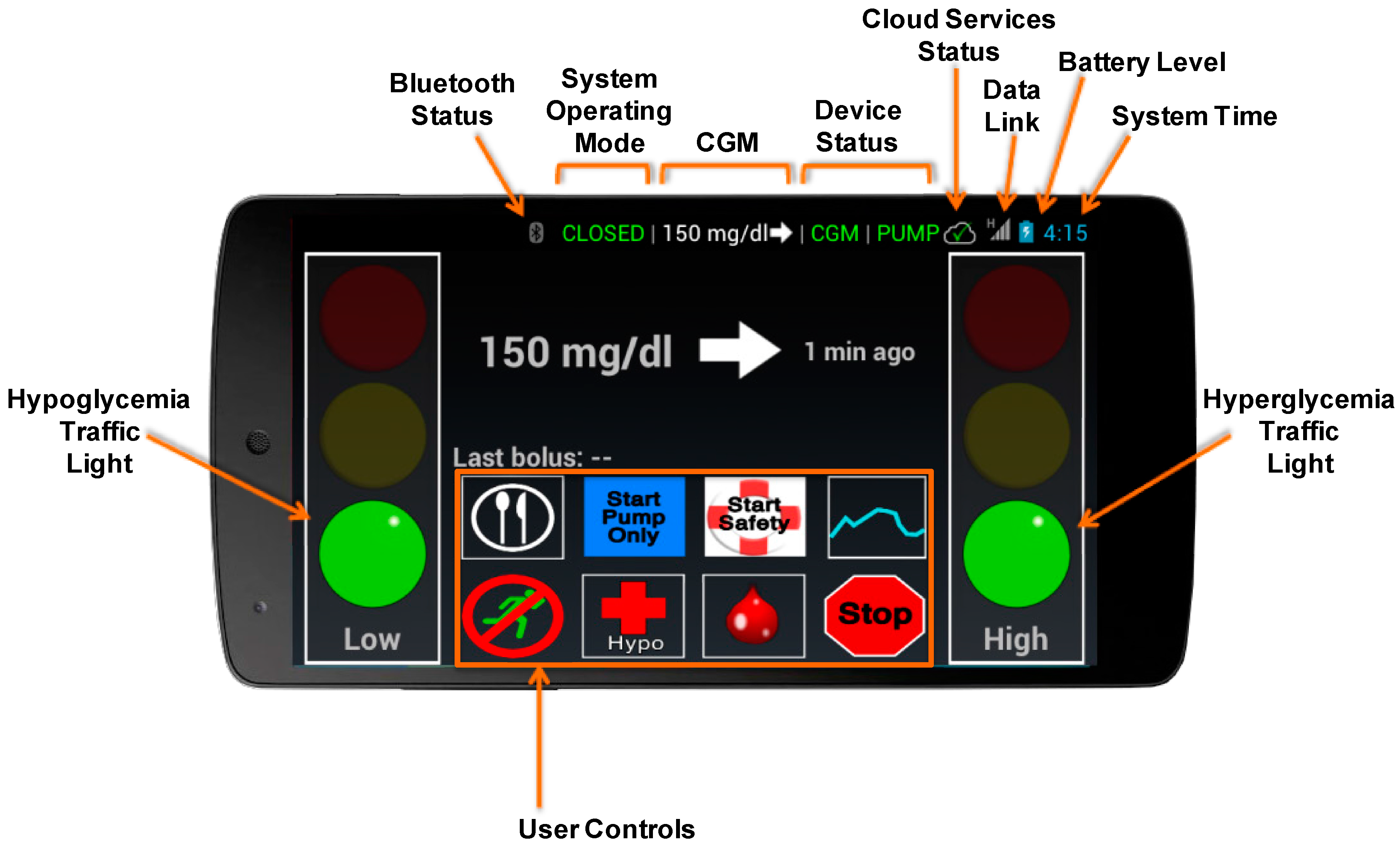 Electronics Free Full Text The Diabetes Assistant A Smartphone Based System For Real Time Control Of Blood Glucose Html