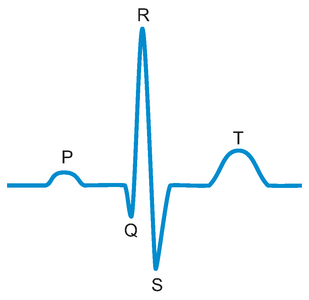 Electronics 05 00075 g002 550