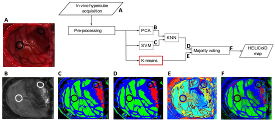 Parallel K-Means Clustering for Brain Cancer Detection Using ...