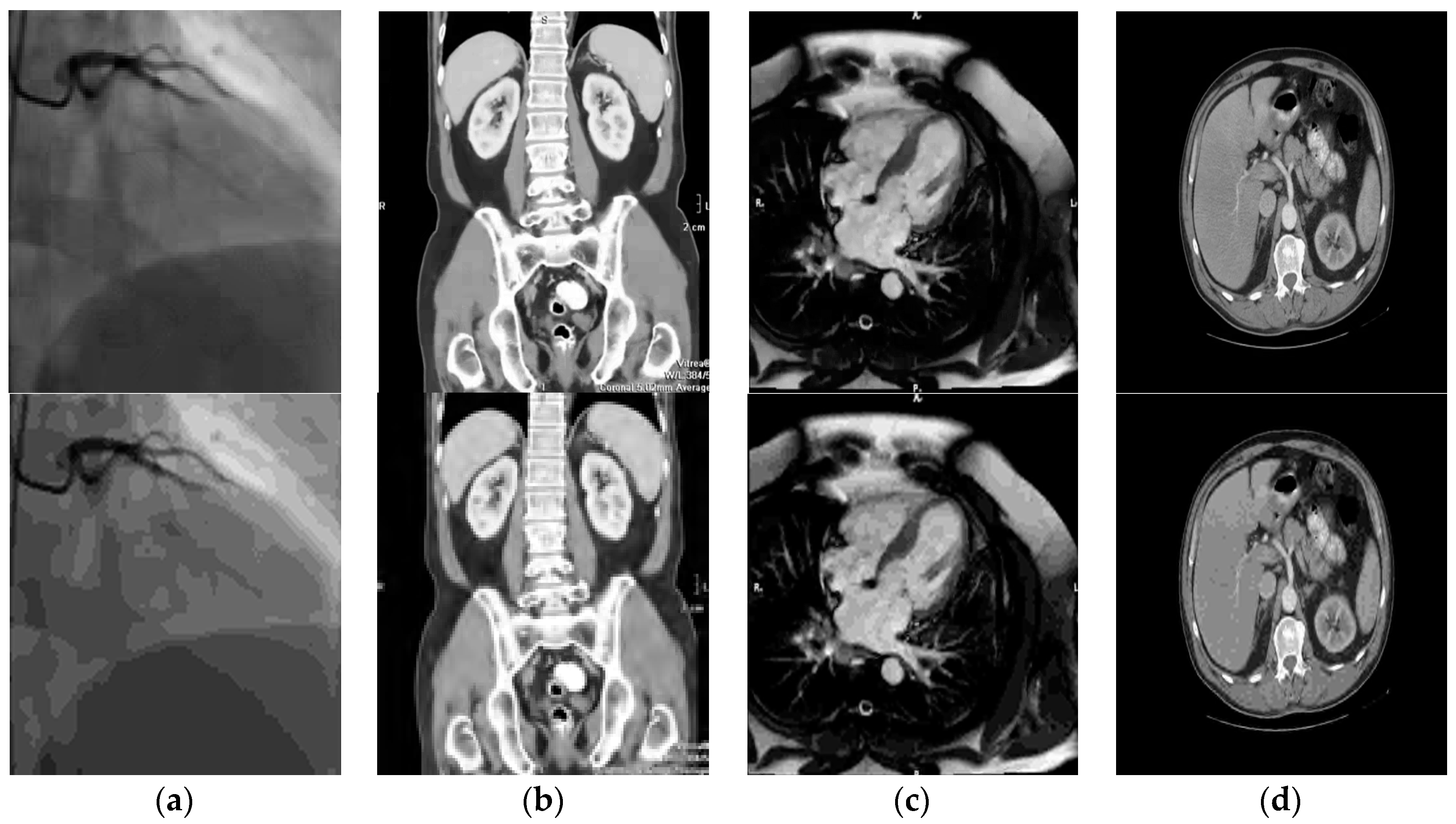Electronics 08 00088 g010