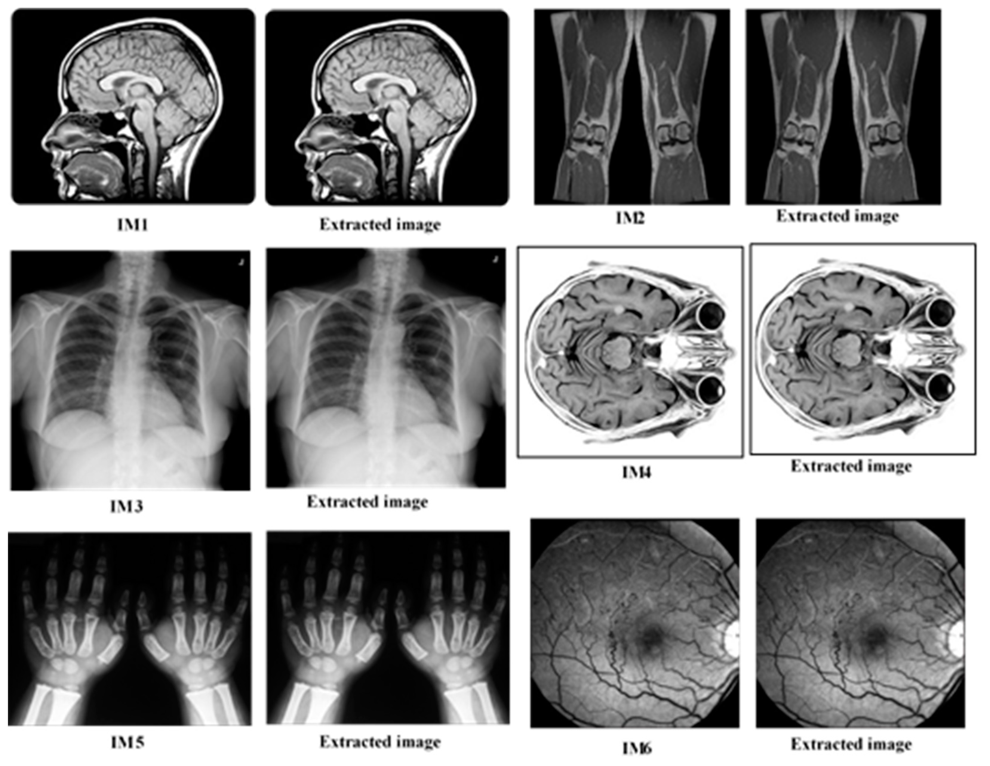 Electronics 08 00171 g013 550
