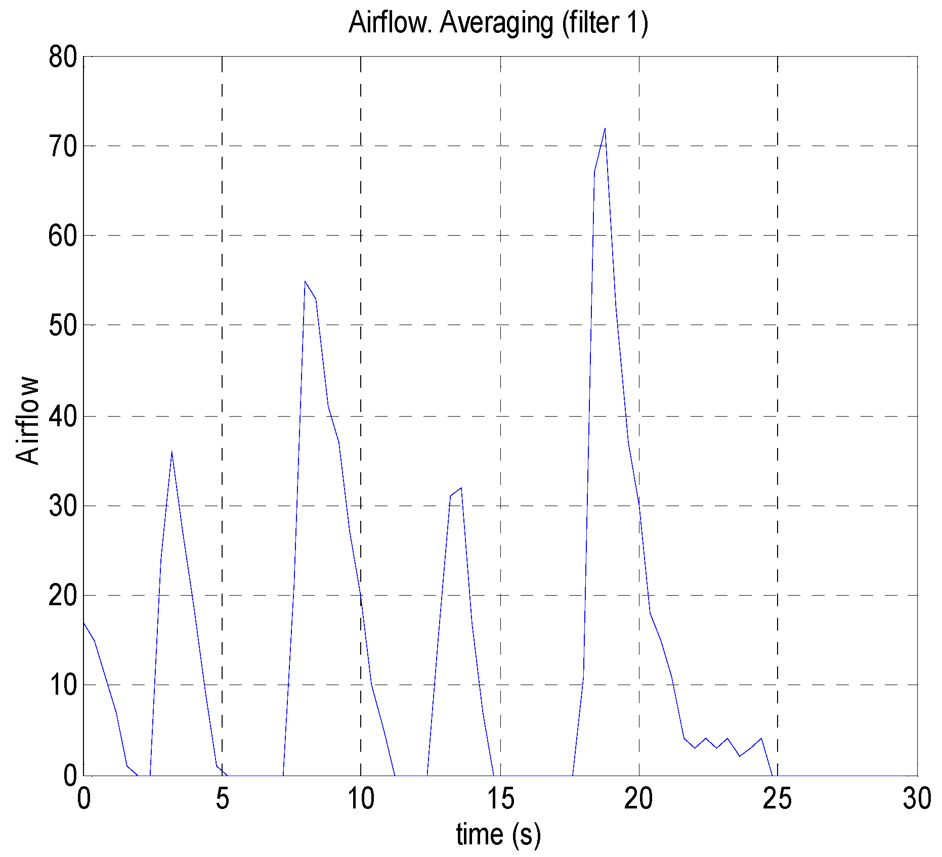Electronics 08 00178 g013