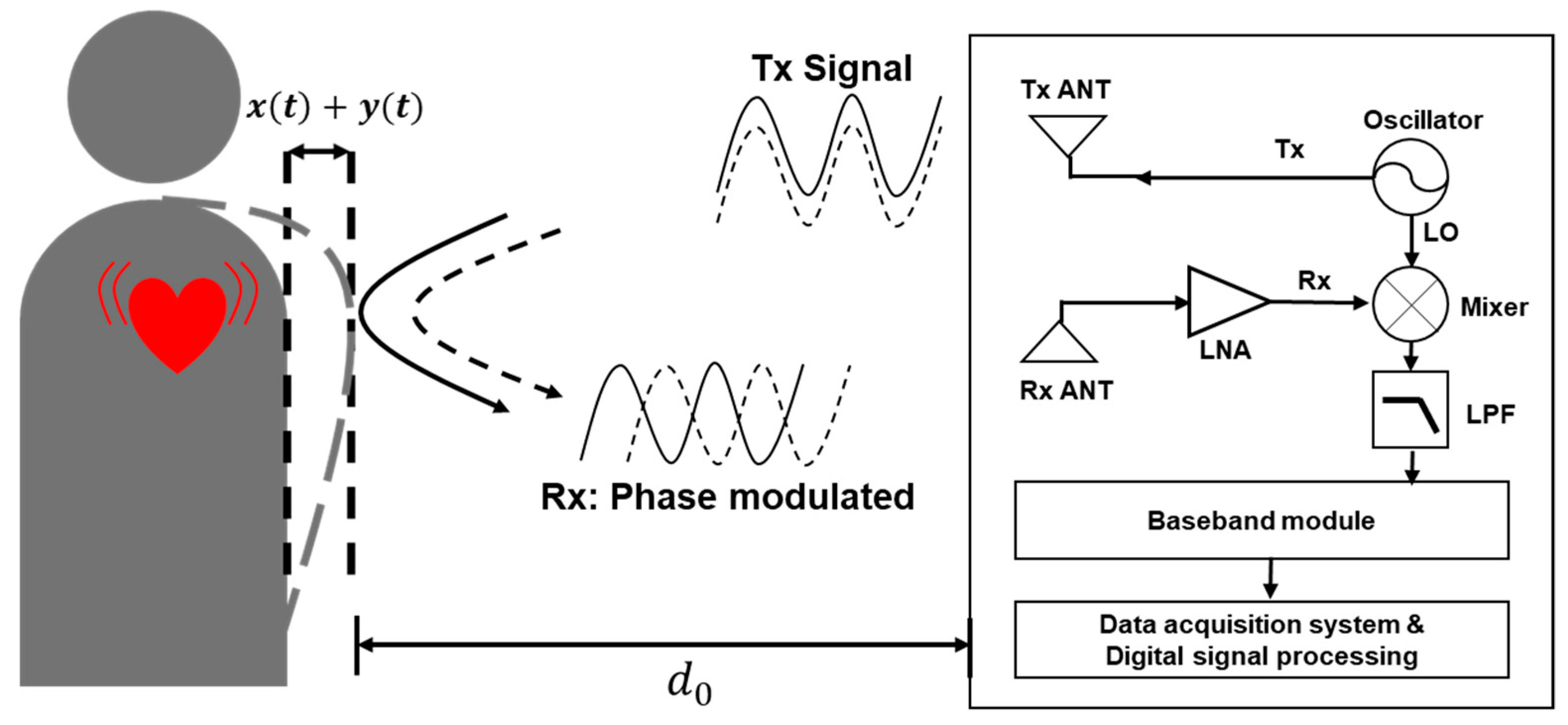 915-MHz Continuous-Wave Doppler Radar Sensor for Detection