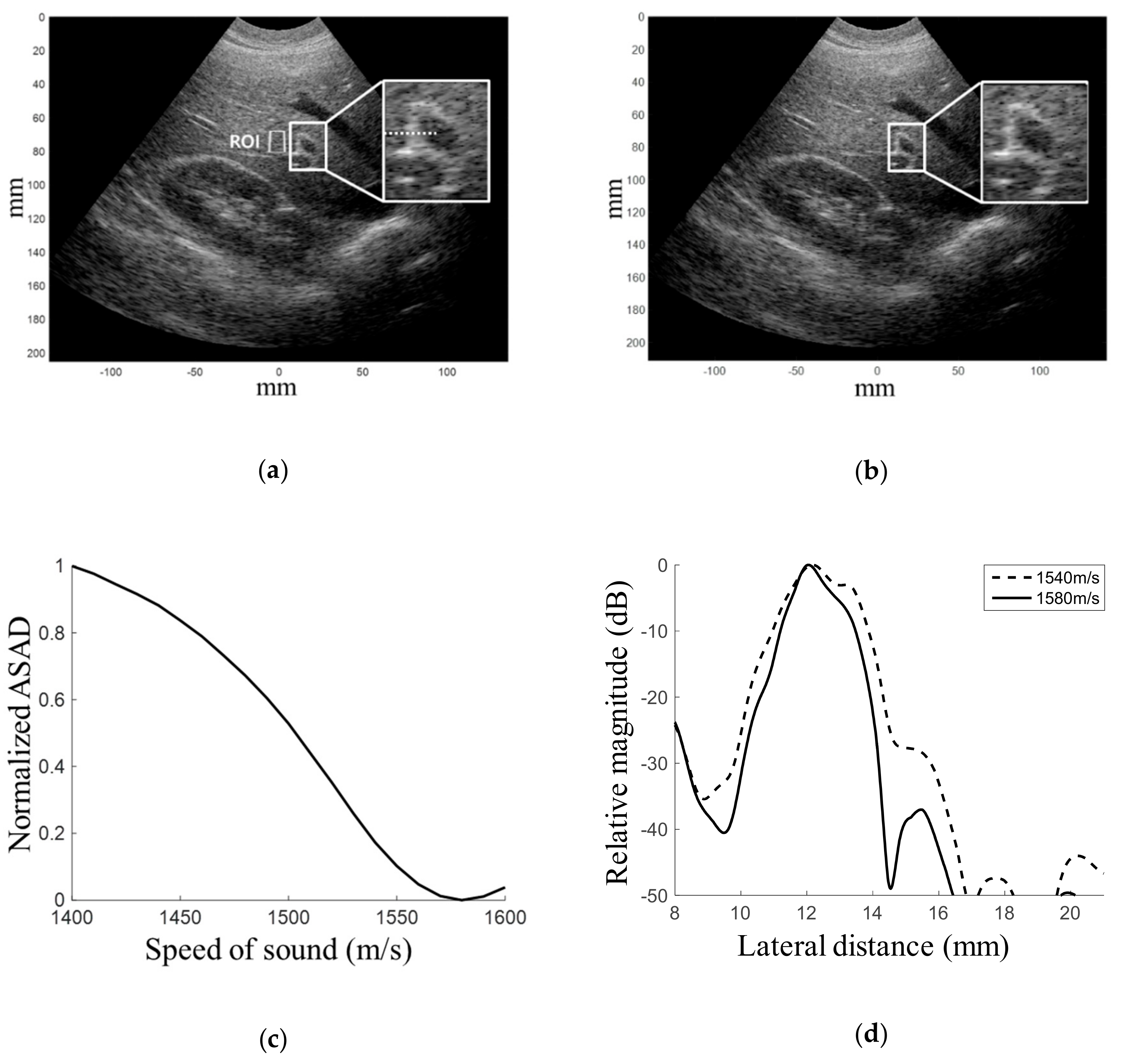 Electronics 08 01368 g004 Electronics 08 01368 g004