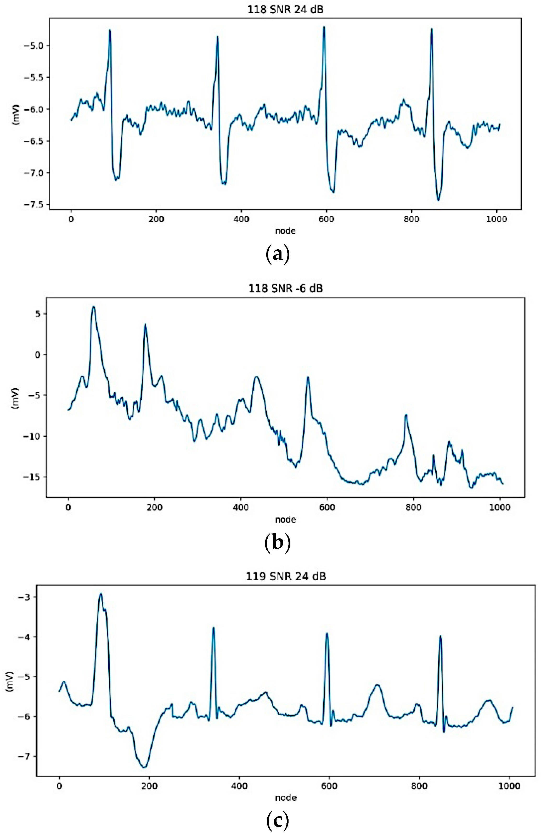 Deep Learning-Based Stacked Denoising and Autoencoder for ECG Heartbeat ...