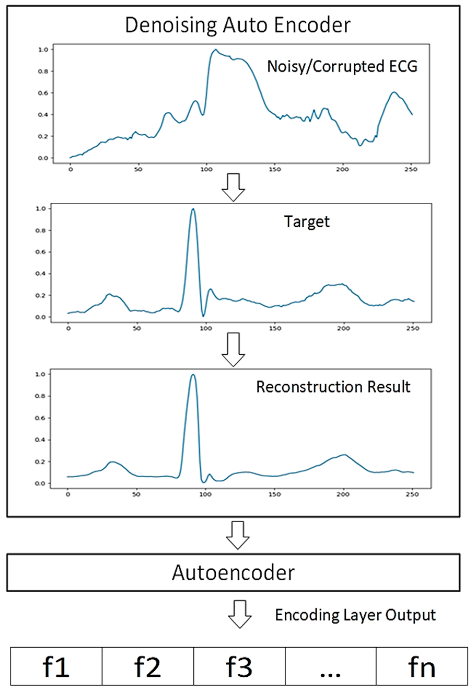 Deep Learning-Based Stacked Denoising and Autoencoder for ECG Heartbeat ...