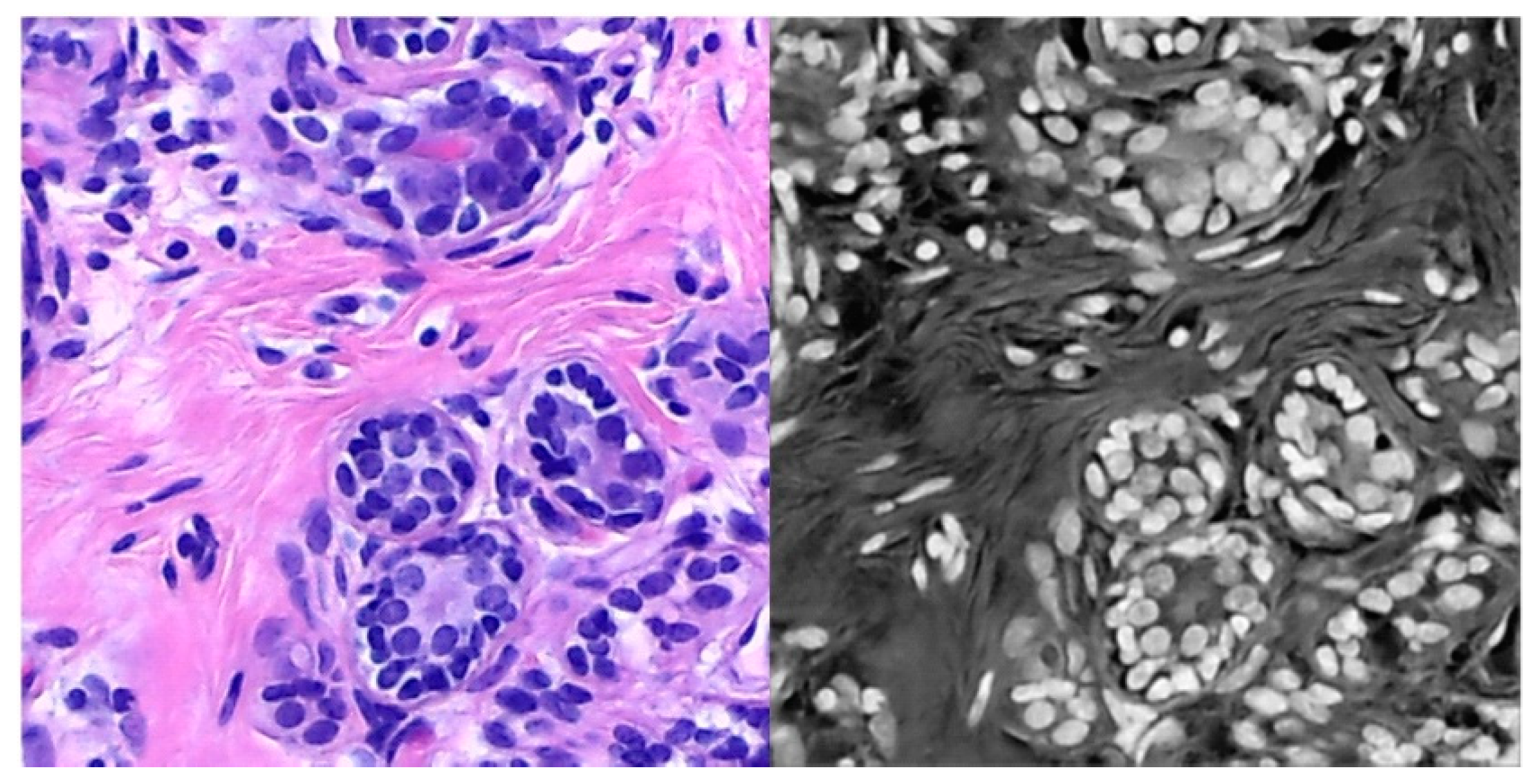 Electronics 09 00445 g011