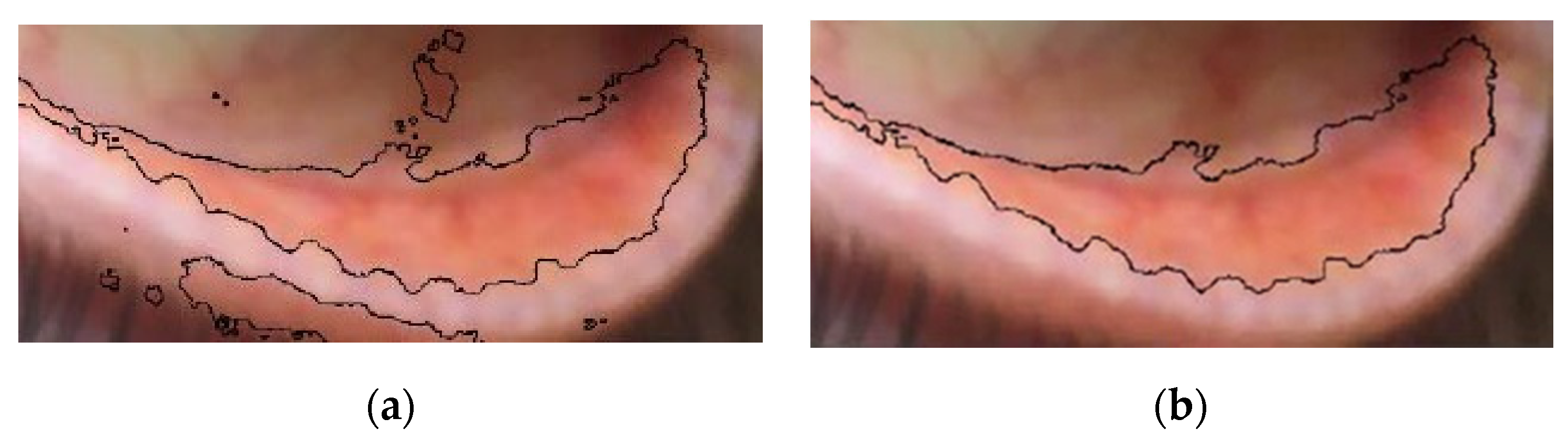 Electronics 09 00780 g004