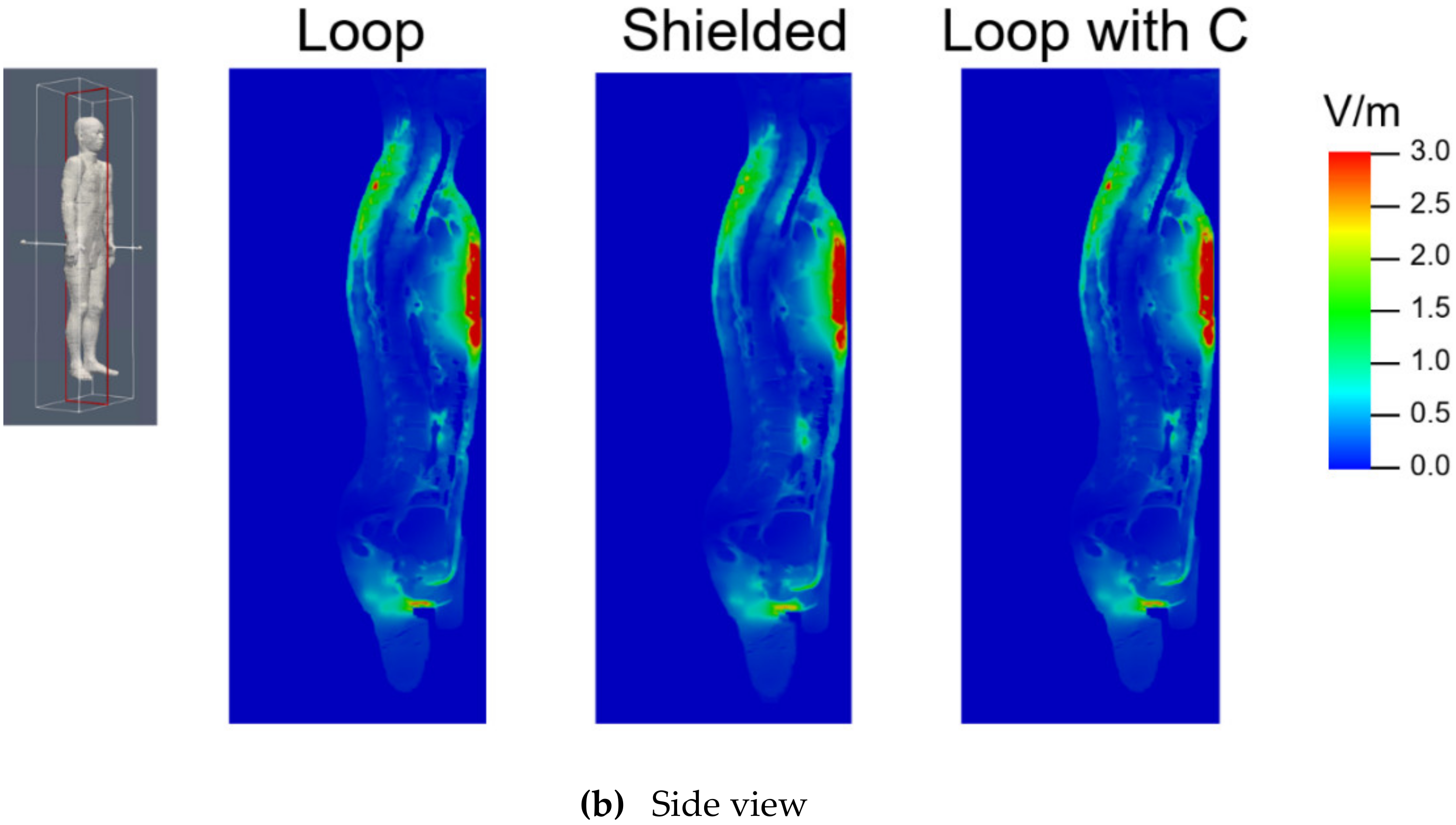 Electronics 09 00953 g007b