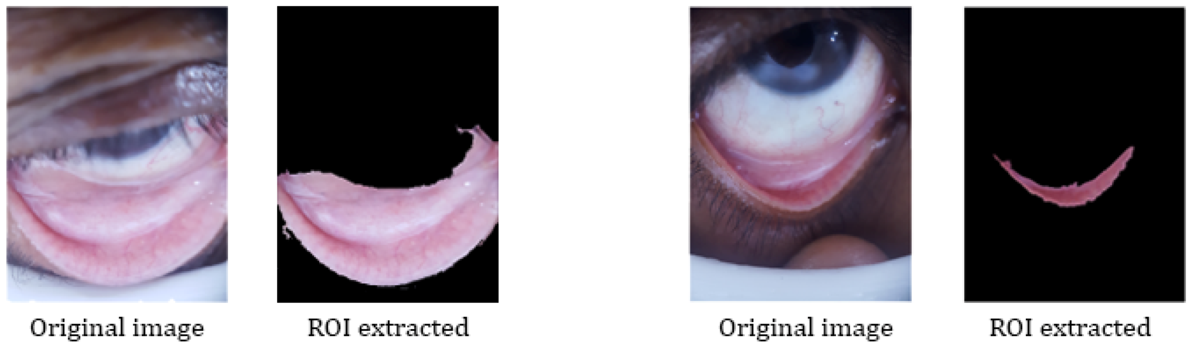 Electronics 09 00997 g009